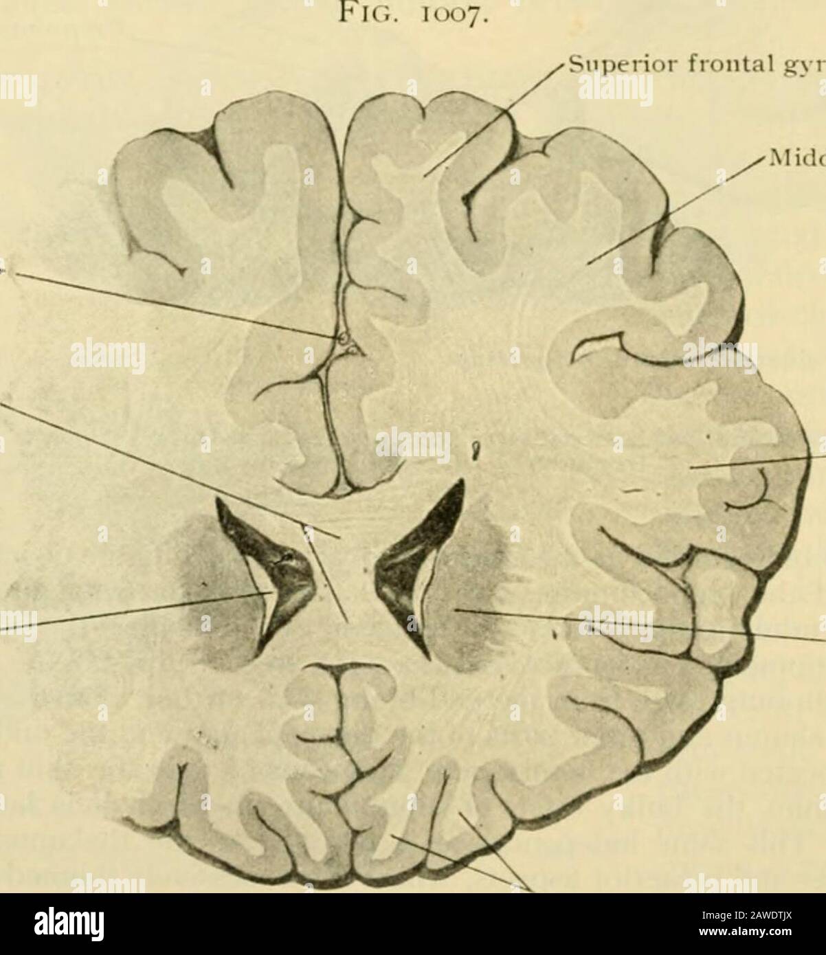 Anatomia umana, comprendente struttura e sviluppo e considerazioni pratiche . f la sua area corticale, l'hippcjcampus, ed è C(jnse(iuentlyported con quest'ultimo nella tromba discendente del ventricolo laterale, in questo modo partsche a (irst si trovano in prossimità e sono stati collegati da percorsi brevi, essere ampiamente separati, con corrispondente allungamento dei tratti di fibra che li uniscono, come illustrato nel lungo corso del fornice nel cervello adulto. Iurther, poiché il percorso di migrazione delle strutture associate di fornixe della tromba inferiore del ventricolo laterale descrive una curva, Foto Stock