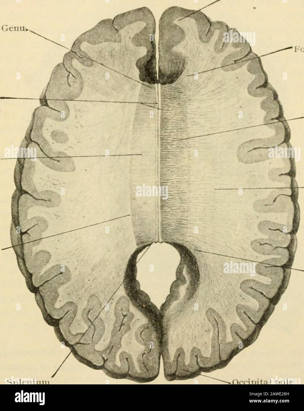 Anatomia umana, compresi struttura e sviluppo e considerazioni pratiche. N convoluzione atrofica, i^yriis suprateral/osus. Forwardand tracciato intorno al genu ricorved e al rostro, lo stria mesiale è prolongeil int(j thegyrus siidca/Zosus, un piccolo tratto corticale crescente sulla superficie mesiale dell'emisfero immediatamente sotto il rostro (Fig. 994); mentre lo stria laterale è continuato nell'area parolfattoria (pagina 1153) e nello spazio perforatedale anteriore. Quando è seguita all'indietro intorno alla splenium, la stria- e grigiastro del corpo calloso diventano continue con Foto Stock
