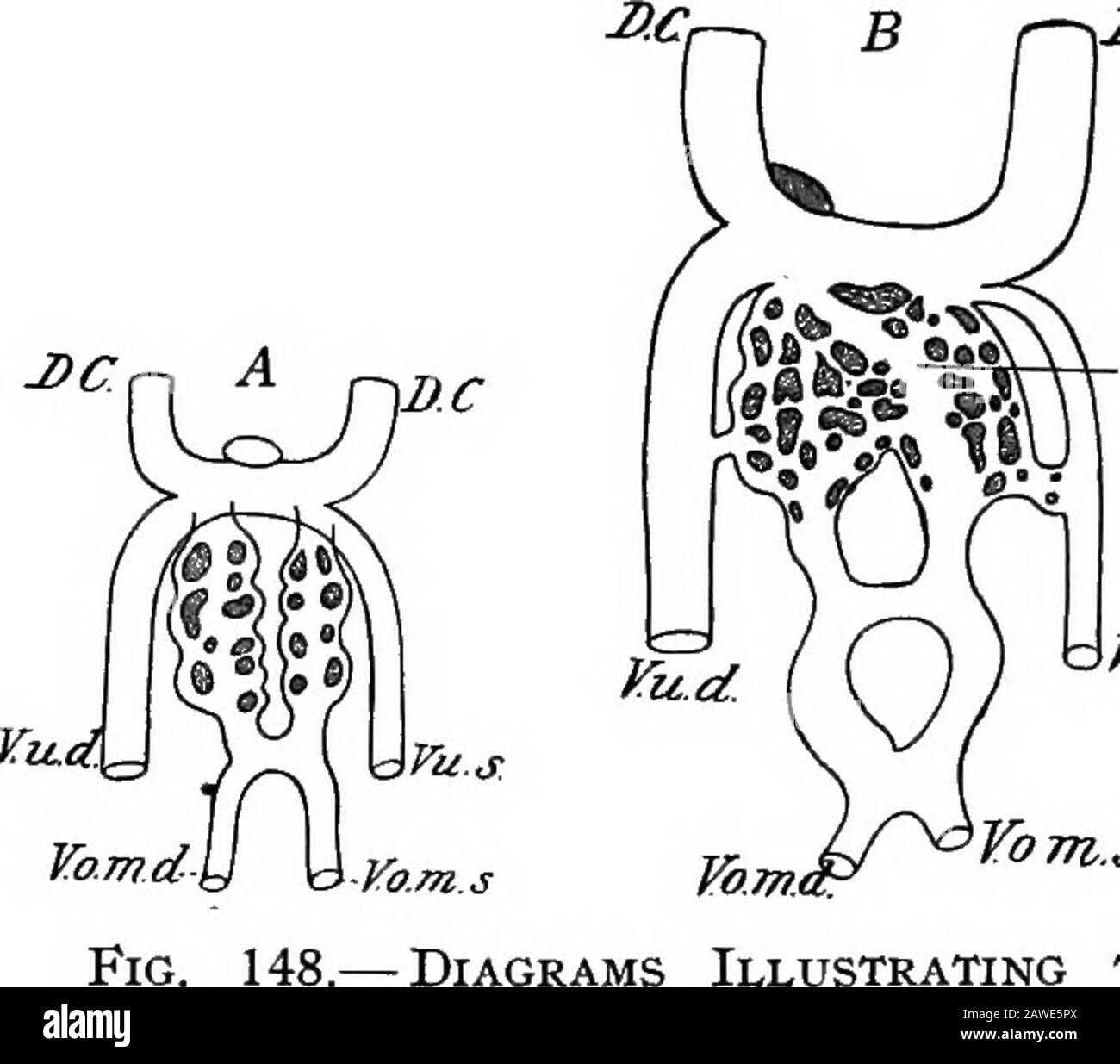 Lo sviluppo del corpo umano; un manuale di embriologia umana. Etwork (Fig. 148, A) attraversare la sostanza epatica e unitingagain per formare due steli che rappresentano le caratteristiche originali delle omphalo-mesenteriche. Dal punto in cui il tronco comune formato dalle vene omphalo-mesenteriche e ombelicali di destra si apre nel Cuvieriandotto si sviluppa una nuova vena, che passa verso il basso e si unisce con l'omphalo-mesenterico di sinistra; questo è il dotto venosus (Fig. 148, B, DVA). Nel tempo medio sono state sviluppate tre connessioni incrociate tra il two24 282 LO SVILUPPO del BOD UMANO Foto Stock
