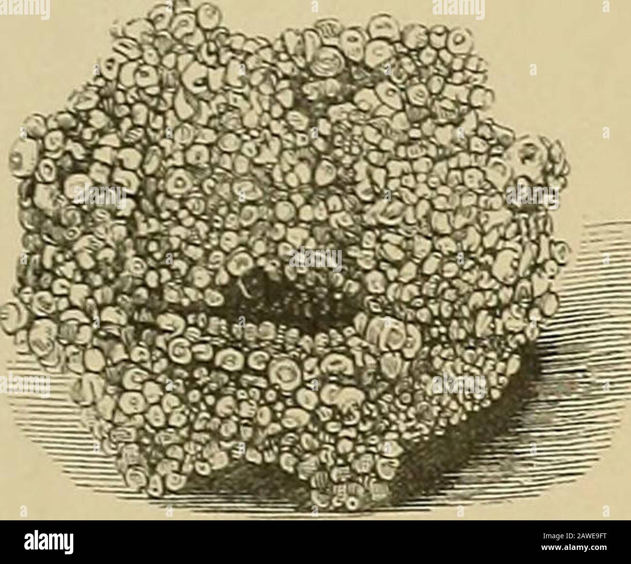 Malattie renali, depositi urinari e malattie calcolose : natura e trattamento . Fig. 3.. Fig. 4. Fig. 2. Foto Stock