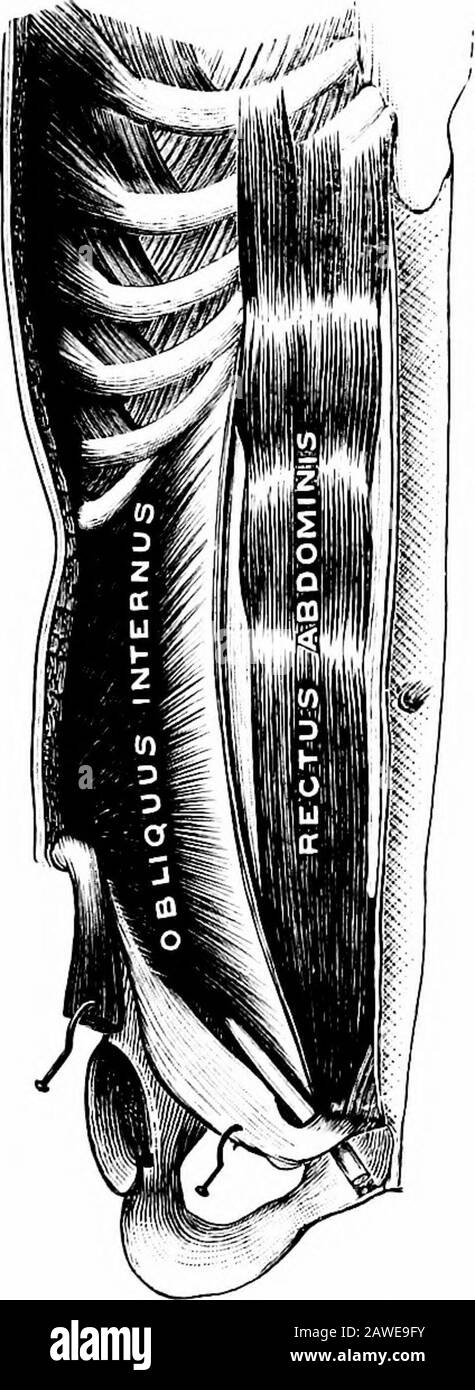 Anatomia applicata e chinesiologia, il meccanismo del movimento muscolare . indietro mostrano la direzione delle pro-tessesse spinose. (Lovett.) nella regione toracica una curvatura laterale ruota il processo spinoso sullo stesso lato e nella regione lombare sul lato opposto. I muscoli principali che flettono la spina dorsale sono i psoas, rettusabdominis ed obliqui esterno ed interno. Questi muscoli, ad eccezione dei psoas, che è stato descritto in precedenza, sono all'interno delle pareti frontale e laterale dell'addome e, insieme al transver-salis, che si trova al di sotto di essi sono comunemente chiamati i muscoli addominali. RECTUS ABDOMINI Foto Stock