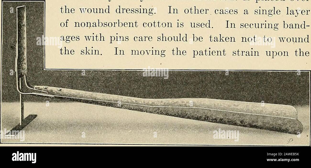 La sala operatoria e il paziente; un manuale di trattamento pre- e post-operatorio acido ic. Se un poco sapone verde è addedle mani sono tenute bianche e morbide. Se le mani si sentono asciutte, lanolinpuò essere strofinato nella pelle. Prima di disinfettare le mani e forearms un cappuccio, maschera e grembiule di gomma devono essere indossati. Dopo che la disinfezione è completata, si mette una gown sterile. Applicazione di medicazioni.^la pelle nelle vicinanze della ferita viene pulita con idrogeno peroxid, quindi solu-zione salina ed essiccata. Le compresse di garza sterili asciutte vengono poste a nextla ferita. Il cerotto adesivo è utile per trattenere il cordone Foto Stock