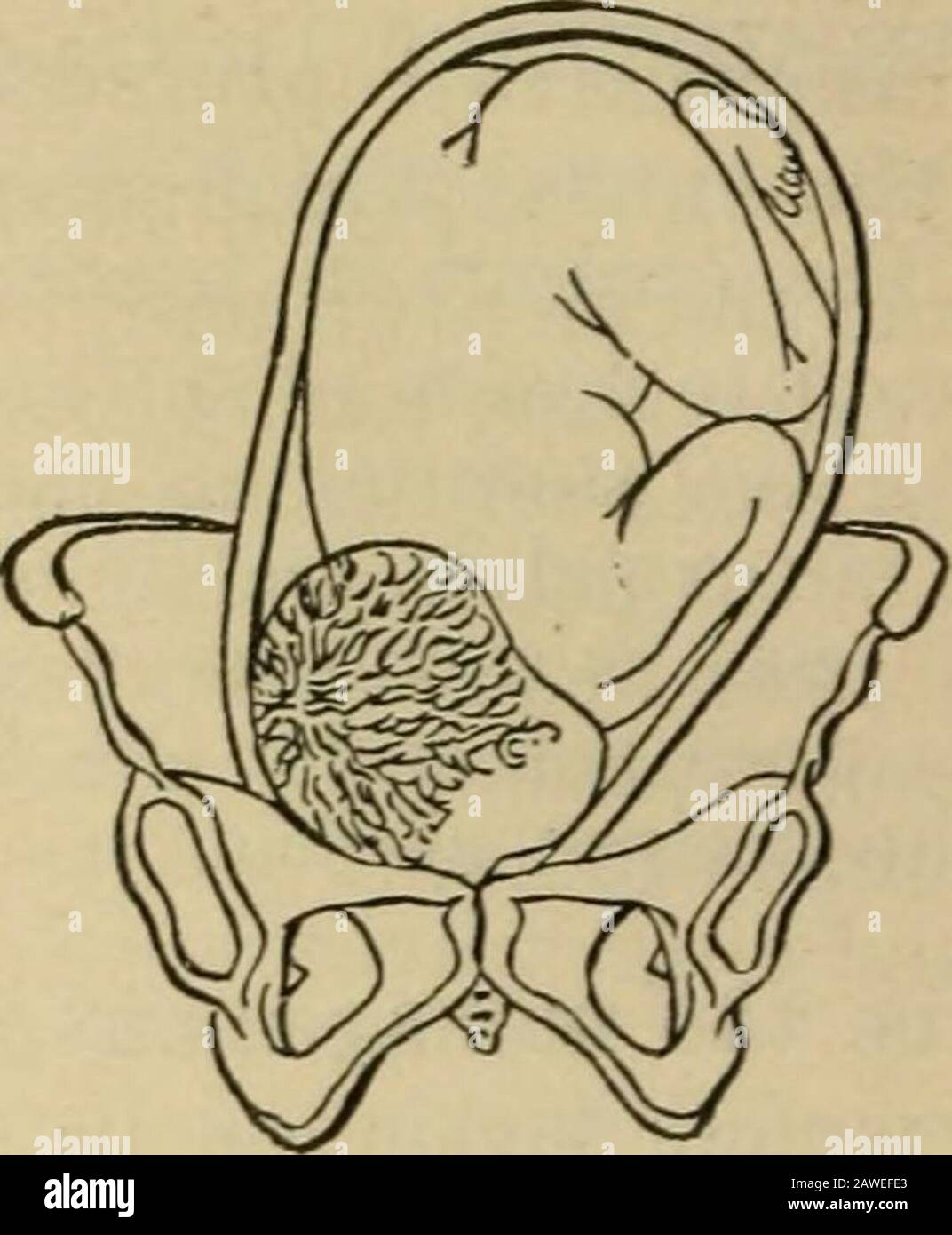 ObstetricsManuale per studenti e professionisti . RM.R L.M-R La seconda posizione corrisponde alla seconda posizione del vertice. Thechin punta alla sinfisi sacro-iliaca sinistra, la fronte anteriormente a destra, L. M. P. (lato sinistro mento-posteriore, fig. 18).   la terza posizione corrisponde alla terza posizione del vertice. In essa la Fig. 19. Fig. 20. Foto Stock