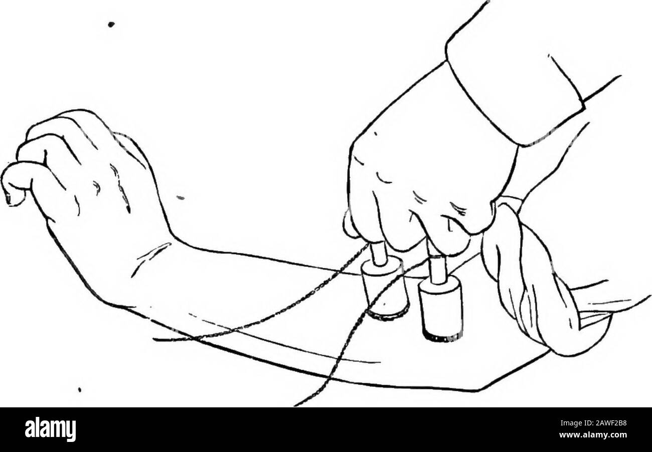 Anatomia applicata e chinesiologia, il meccanismo del movimento muscolare . e dita si può fare con un polso sovraesteso e quanto meglio l'azione è quando yohold in parte flesso. Posizionando le punte delle dita sulla parte anteriore dell'avambraccio inferiore si può facilmente sentire il flessore carpi radialis e thepalmaris longus contratto ogni volta che si fa un forte sforzo per allungare le dita. L'extensor communis separa anche le dita mentre si estende. Non è in grado di spostare le dita indipendentemente al samedegree come i flessori a causa di tre bande fibrose che collegano ESTENSOR COMMUNIS DIGITORUM Foto Stock