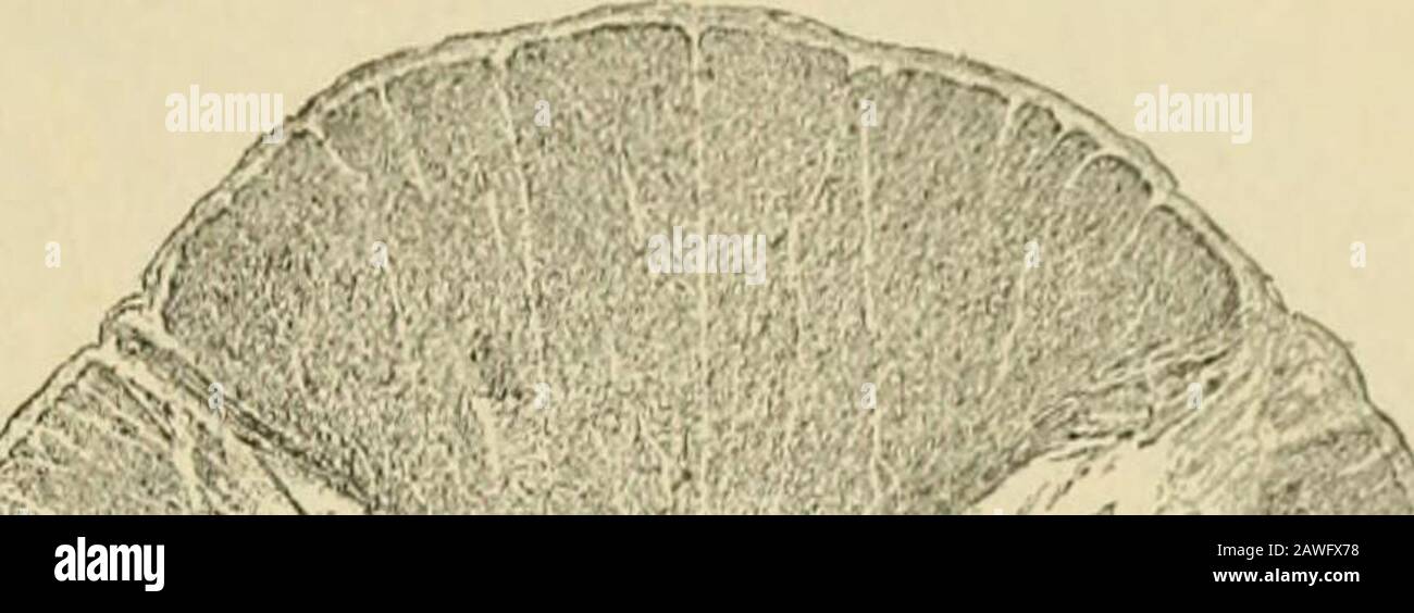 Anatomia umana, compresa la struttura e lo sviluppo e considerazioni pratiche . corno rior ; S. C, ganglio spinale. MATERIA BIANCA DEL MIDOLLO SPINALE. 1041 sezioni del cordone nel reg-ione cervicale il lil hjiiy^res entrando;- dalle radici lowernere occupano la parte interna della colonna Golls, ma sono esclusive dal mediansetto, tranne dietro, da una stretta area emiellittica, che con il suo accoppiamento del lato teop{)osite forma il campo ovale ol hlechsig. Le fibre che entrano dai nervi toracici inferiori si trovano più lateralmente, mentre quelle che entrano dai nervi toracici superiori e cerici appropriato th Foto Stock