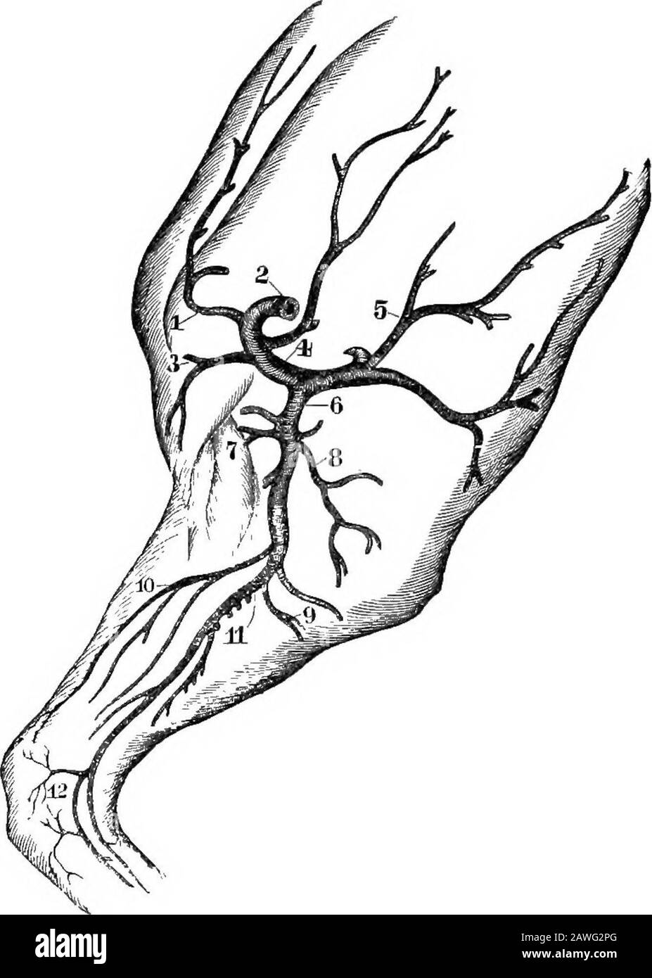 Il cavallo americano riformato libro, un trattato sulle cause, i sintomi e la cura di tutte le malattie del cavallo, compreso ogni malattia peculiare all'America, anche l'allevamento, e la gestione. D sera. Alcuni casi, tuttavia, sono incurabili, a causa dell'organicopatia dei bronchi, o della rottura di cellule d'aria nei polmoni. I Suchcases sono conosciuti dalla respirazione innaturale quando il cavallo isdrawing un carico pesante o che viaggia su collina. La sua respirazione è molto doloroso, e non solo porta in gioco i muscoli addominali, ma anche i muscoli del petto (intercostali). Valigetta Foto Stock