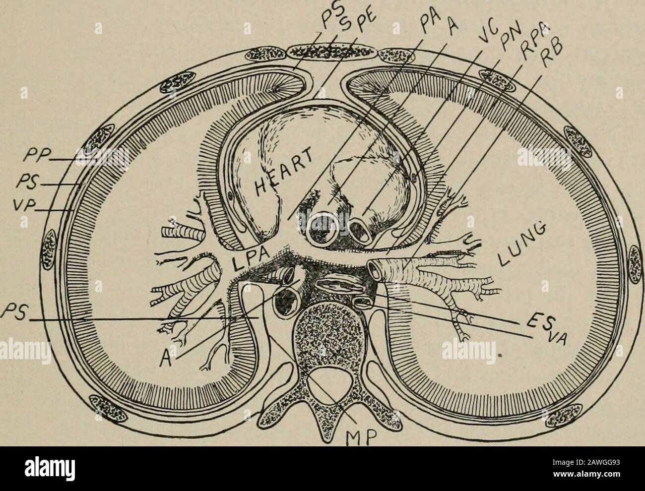 Chirurgia operativa, per studenti e praticanti . non è grande, ed è occupato da esofago, dotto toracico, aorta toracica, vena azigos, vena emiazygos, e vari nervi. Nella parte superiore del mediastino, di fronte, è il timo o itresti, e dietro questo la trachea e l'esofago, quest'ultimo lyingappena davanti alla colonna vertebrale. Immediatamente sopra la base del cuore si trovano i grandi vasi collegati al cuore, l'arco ]IEDIASTINUM E I CONTENUTI. 283 dell'aorta, vena cava superiore, arteria polmonare e suoi rami, e la biforcazione della trachea. Un numero di l Foto Stock
