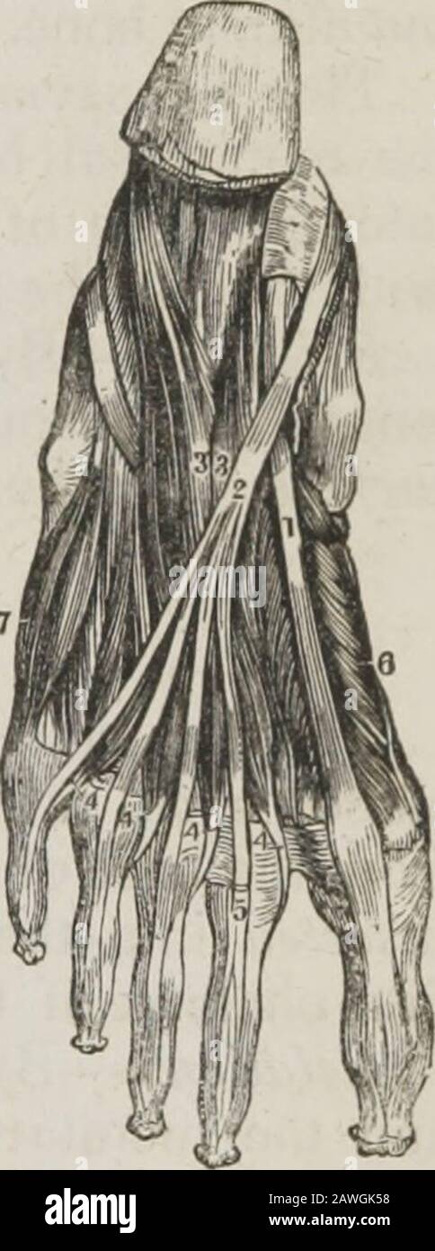 Un sistema di anatomia umana, generale e speciale. Le ossa sono sviluppate nei tendini di inserimento di queste due teste, e il tendine del pollicis di theflexor longus si trova nella scanalatura fra loro. Relazioni. Dalla sua superficie superficiale, con il pollicis abductor, tendine del pollicis flessore longus e fascia plantare. Con la sua superficie profonda, con le ossa tarsiche e i loro legamenti, il metatarsalosso della punta grande, e l'inserimento del tendine del peroneuslongus. Con il suo confine interno, con il pollicis abductor ; e con il confine itsouter, con il pollicis adduttore; con entrambi questi muschi Foto Stock