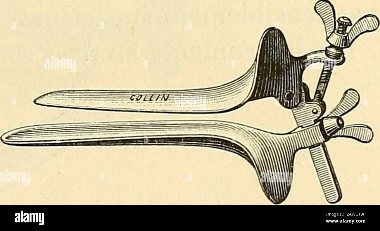 Traité de gynécoologie clinique et opératoire . A B Fig. 74. Spéculum à doppio movimento. A. Spéculum à doppio mouvement, de Collin (avec manche). Autre spéculum de Collin à doppio mouvement (sans manche). Taillé à angolo droit. Il est nécessaire davoir au moins trois calibersdifférents de ces spéculums. Pour les introduire il est bon de les immerger dabord rapi-dement dans leau tiède de façon à éviter que leur surface brillantesoit ternie par la buée du vagin. On les enduit extérieuremement devaseline et on prégente obligement de bas en haut lextramité àlorifice vulvaire écarté avec les d Foto Stock