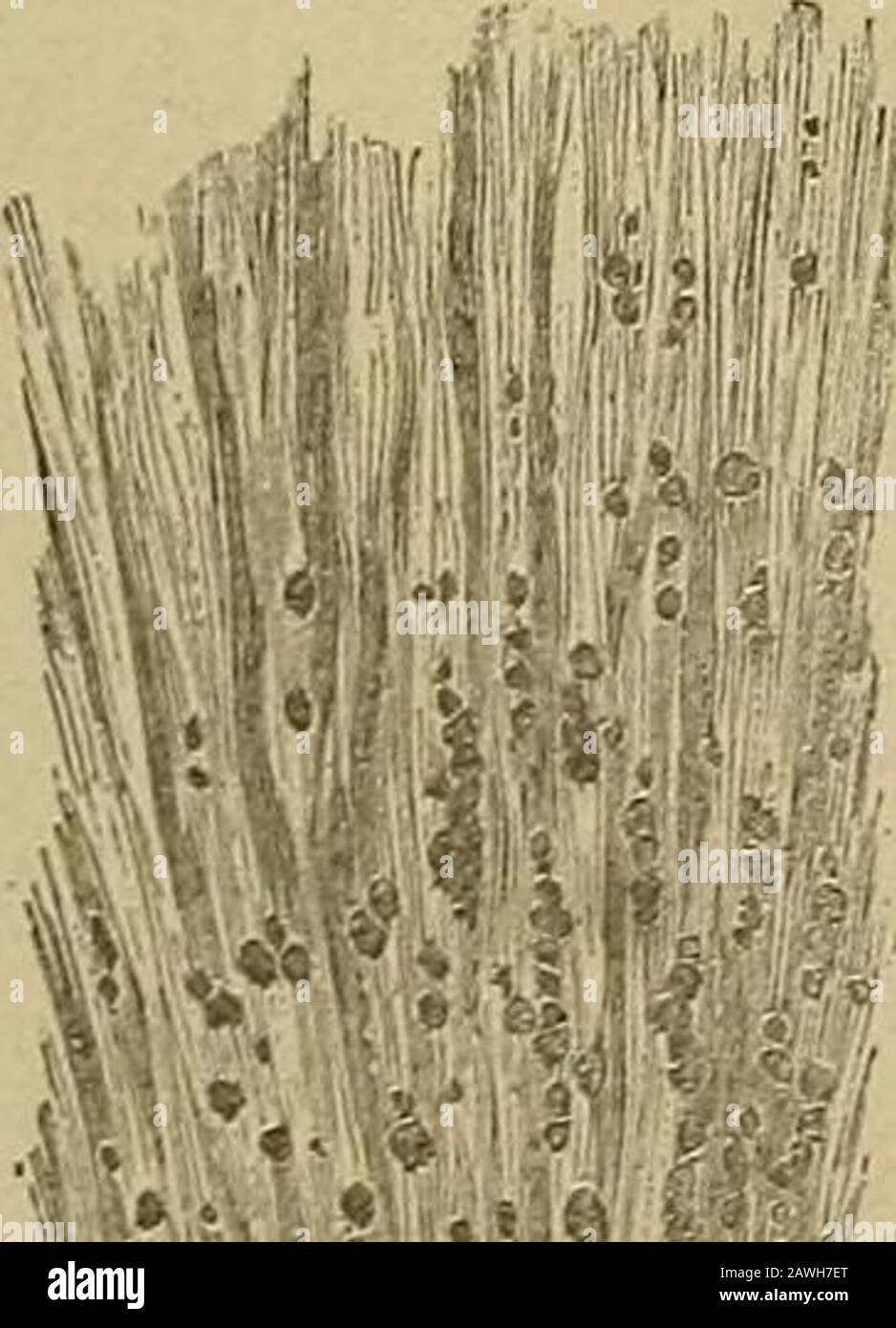 Malattie renali, depositi urinari e malattie calcolose : natura e trattamento . £w^[ s Matter e blcX 29. IOH sono   1.of F 12. Fig. 30. -.- til. Cristalli di leucina? di rene. BUI X 20. P ?/ c &gt;: -, ^ &;/? TL- ©^ igmfied.Specimen. -= alta 13. Foto Stock