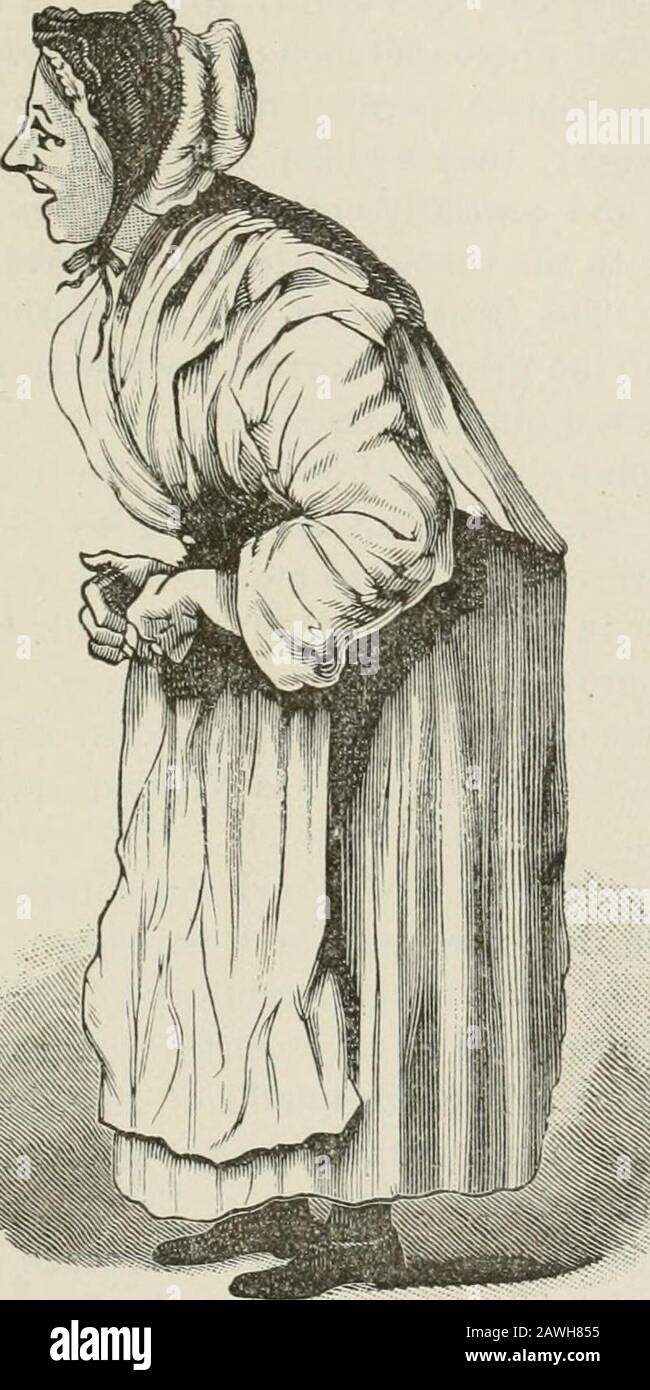 Conferenze sulle malattie nervose dal punto di vista della localizzazione cerebrale e spinale, e i metodi successivi impiegati nella diagnosi e nel trattamento di queste affezioni . età della malattia. Le funzioni sensoriali sono raramente alterate, né l'irritabilità elettrica dei themuscles è materialmente alterata. In alcuni casi è stato osservato un aumento dei riflessi più profondi. A j)l'ecularità dell'espressione facciale è comunemente osservata nelle vittime della paralisi agitans. Si descrive come paragonabile ad una maschera, perché c'è così poco gioco delle caratteristiche. Molto spesso la bocca è aperta e la saliva dr Foto Stock