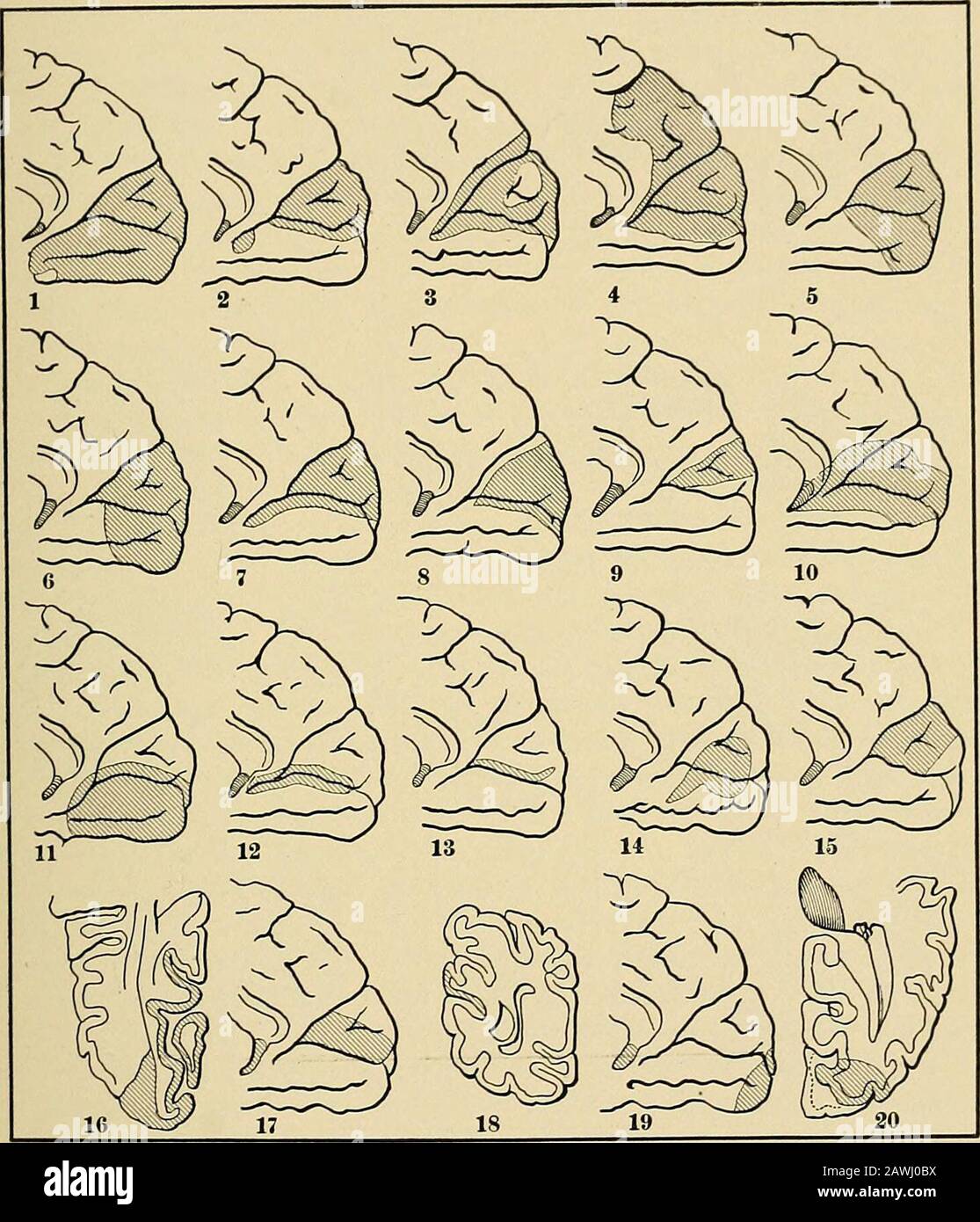Un sistema di medicina pratica è definitelyknown. Wildbrand ritiene che la macula lutea sia innervata da entrambi Vialtt crede che il centro corticale della visione occupi l'intera superficie mediana del lobo teoccipitale (Lcs Centers cercbrcmx c/e la Virion et IAppdricil, 1893), citato da Mills. ^ Brain, vol. xvi., 189.3, pag. 177. ^ Ihid. * Pathnlocfie dcs Gehirm. ^ M. .Vllen Starr: The Visual Area in the Brain determinato da uno studio Di Hemi-anopsia, Ama: Journ. Med. Sei., gennaio 1894, pag. 6.5. ^ ¥j. C Sequin : viaggio di Nerv. E uomini I. Dis. Vol. xiii., Gen., 1896, pp. 1-38. Henry Hun: Amer. Viaggio Foto Stock