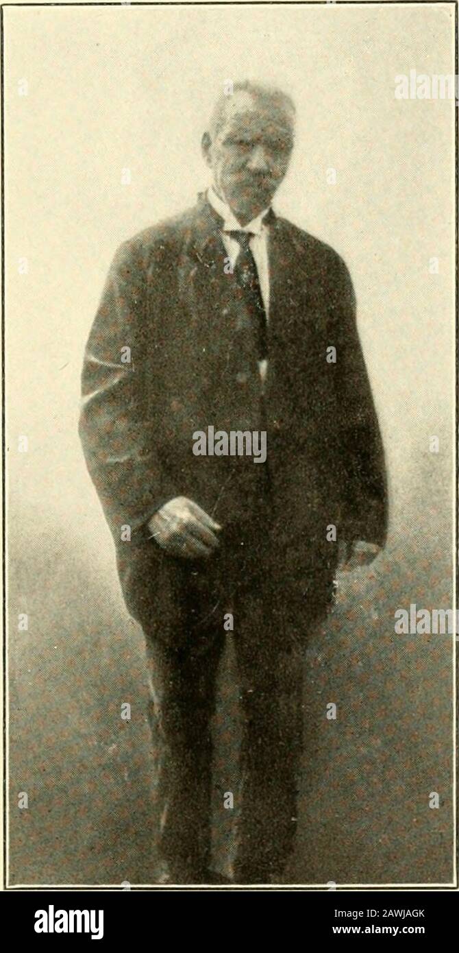 Geriatria : le malattie della vecchiaia e il loro trattamento, compresa la vecchiaia fisiologica, le cure domestiche e istituzionali, e le relazioni medico-legali . Tremorgraph: Paralisi agitans, mano sinistra. (Neustaedter, Med. Record, 17 Luglio 1909.). Paralisi precoce agitans; caratteristica del viso come-pect. Atteggiamento non yetpronounced. (Dr M. Xeustaedterscase.) PARALISI AGITANS 377 di un tumore, dobbiamo ricorrere a misure temporanee per ridurre la circolazione techerebrale. Le misure più efficaci per questa pur-posa sono piede caldo o bagni di sitz. L'iperemia locale in altre parti del corpo può essere prodotta dalla senape, turp Foto Stock