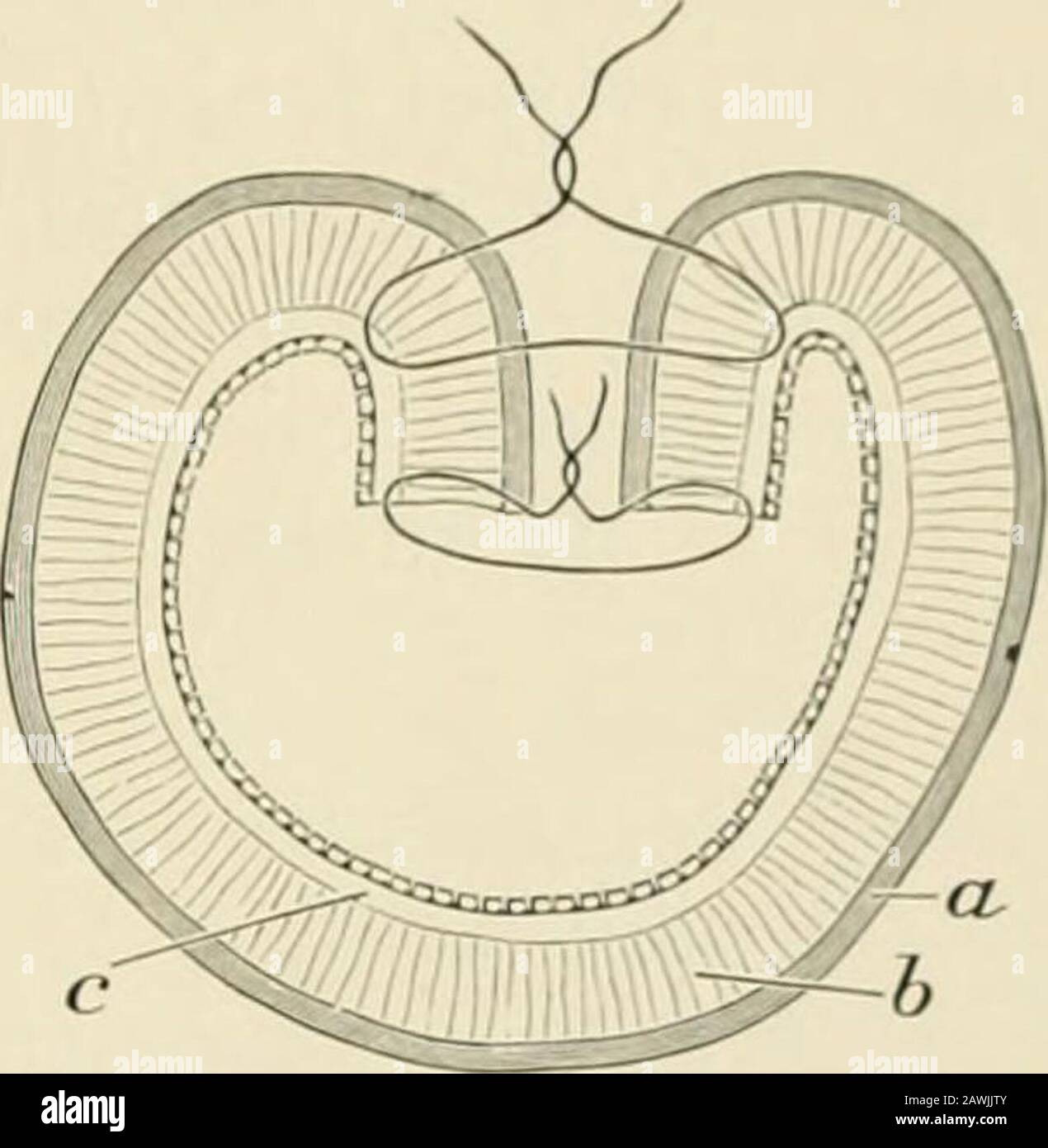 Chirurgia operativa . Fig. 787.- la sutura Lembert, a.. Rivestimento protettivo. J). Rivestimento muscolare c.. Rivestimento fibroso submucoso. Fig. 788.-la sutura Czerny-Lembert.a. Cappotto sieroso. B. Rivestimento muscolare, c.. Rivestimento fibroso submucoso. La Sutura Lembert.- con questo metodo i bordi sierosi sono inpiegati (Fig. 787) e le suture vengono fatte passare attraverso di esse a circa un decimo di pollice dai bordi della ferita, essendo disposte intorno alla stessa distanza. Il numero di punti e la quantità di tessuto inclusa saranno generati dallo spessore del tessuto e dal ceppo esercitato. Therapidity di cucito intestinale può essere inc Foto Stock