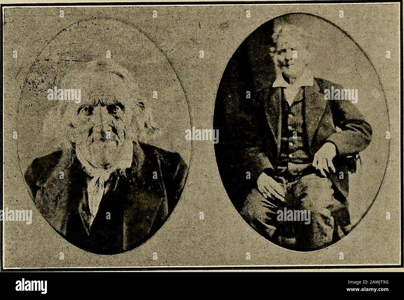 Storia e directory di Newton e Ransom Townships, Lackawanna County, Pennsylvania; . compagni lo accompagnavano a casa, mentre l'altro ha preso un diritto cour.se attraverso i boschi a Lackawanna per procurare i servizi del Dr. Hooker -Smith. Era due giorni dopo che la ferita è stata inflitta prima che il Dott. Smith couldbe sulla mano. Quando venne il braccio fu muchinflamed e gonfio, e la sonda, cuttingand picking schegge d'osso era un'operazione terribile, ma doveva essere sopportata.La ferita era un certo tempo in guarigione, e la lesione dell'articolazione era tale che la conse- fattoria, vicino alla casa Hillside. Lui Foto Stock