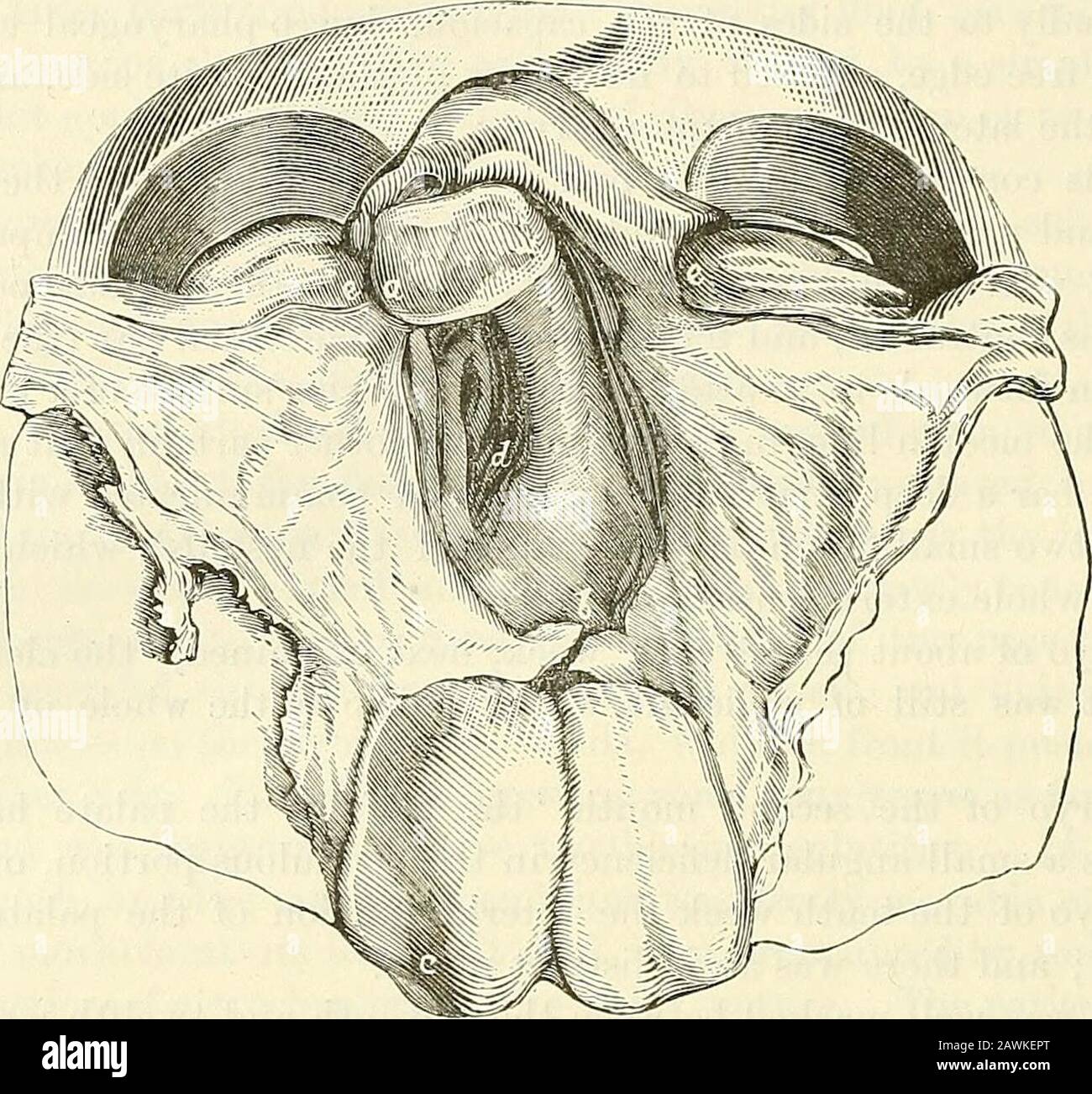 Un sistema di chirurgia: Cresta alveolare teorica e pratica su un lato o sull'altro della medianline, Tornando in un'intera tacchera del palato.^ ^ Può essere considerato come il futuro os incisivum o l'osso iutermaxillare.^ la tacchera degli alveoli in tali circostanze è spesso completa ovunque sul lato opposto, dalla parte anteriore alla capanna, e dalla bocca alla narice. ^ Al Posto della cresta alveolare che è cleft, come descritto, in questa varietà, ci possono essere solo K K 2 500 MALATTIE DELLA BOCCA, FARINGE, E (ESOFAGO. 3. Il crinale alveolare intero; la sfaldatura del palato che inizia l'imm Foto Stock