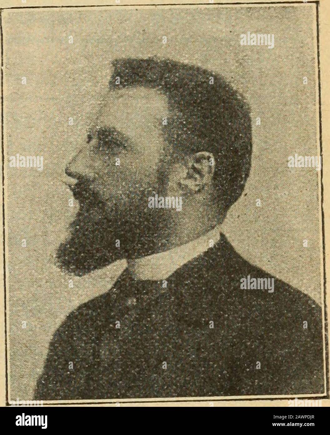 Traité d'hygiène . Clinique et Opératoire. A. LE DENTU Pierre DELBET Professioneur de clinique chirurgicale Professioneur agrégé à la Faculté de médecine de Paris, à la Faculté de médecine Chirurgien de lhôpital Necker, de Pans Membre de lAcadémie de médecine. Chirurgien des hôpitaux. Principaux COLLABORATEURSAlbarran, Castex, Faure, Legueu, Mauclaire, Ricard, Schwartz, Sebileau Professions agrégés à la Faculté de médecine de Paris. Arrou, Guinard, Lyot, Morestin, Rieffel, Souligoux Chirurgiens des hôpitaux de Paris. Gangolphe, Jaboulay (Lyon), Binaud, Braquehaye, Villar (Bordeaux) Cahier, Nimier (V Foto Stock