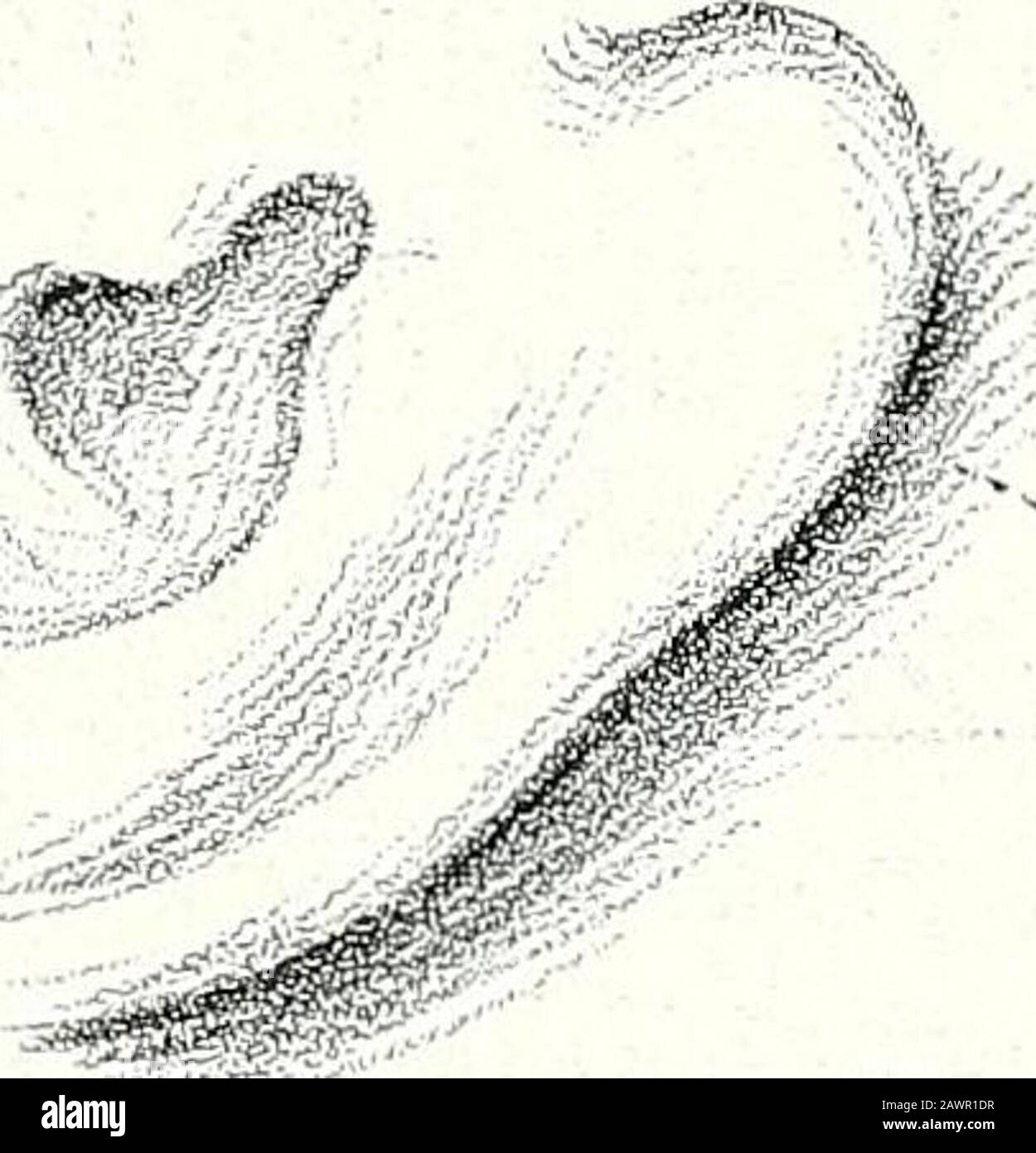 Terapie chirurgiche e tecniche operative . Fig. 288.- esposizione e sezione Dei Rami Mastoidi del nervo Spinale; schizzo generale. T5S5eE«5.. Foto Stock