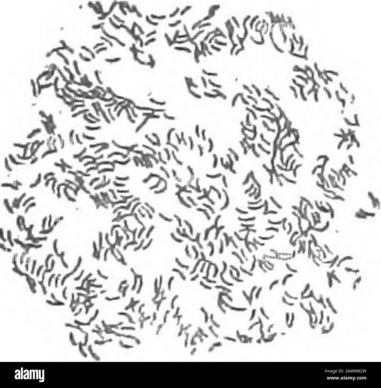Essentials of batteriology; essendo un'introduzione concisa e sistematica allo studio dei batteri e delle microörganisms alleate. Preparazione di pressione mostra questi processi del ragno-gamba consistono di bacUU nell'ordine regolare. Stab-culture.-^la gelatina presto liquida, uno strato grigio sul thesurface, ma la parte principale della coltura in piccole briciole sul fondo. Agar.: Crescita rapida, umida e grigia. Latte.^coagulazione Acida. Brodo Destrosio - Produzione Di Gas. Patogenesi.- Conigli e cavie iniettati subcutane-ously muoiono rapidamente; una forma di toxemia, condizionamento emorragico dei polmoni e degli intestini, presente. Quando neurina Foto Stock