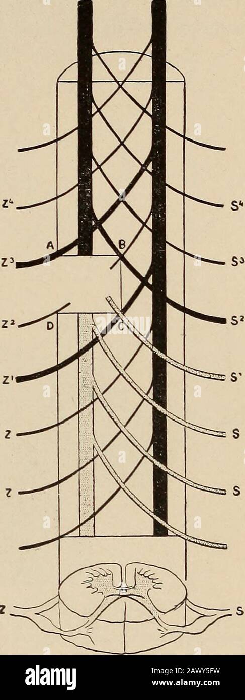 Malattie nervose e mentali. Poste principalmente dietro il territorio più stretto. Le lesioni corticali in questo campo portano a disturbi parestetici di sensazionee che hanno limiti funzionali piuttosto che anatomici-ical, proprio come la stimolazione elettrica della corteccia porta a movimenti purposi o groudedmuscolari, e non a quelli sotto-serviti da qualsiasi segmento spinale o nervo-tronco. In anestesia isterica si nota una similardistribution, l'area interessata avendo il contorno della superficie coperta da un guanto, calzino, o manicotto, e limitata con precisione all'area funzionale che è l'oggetto dei pati Foto Stock