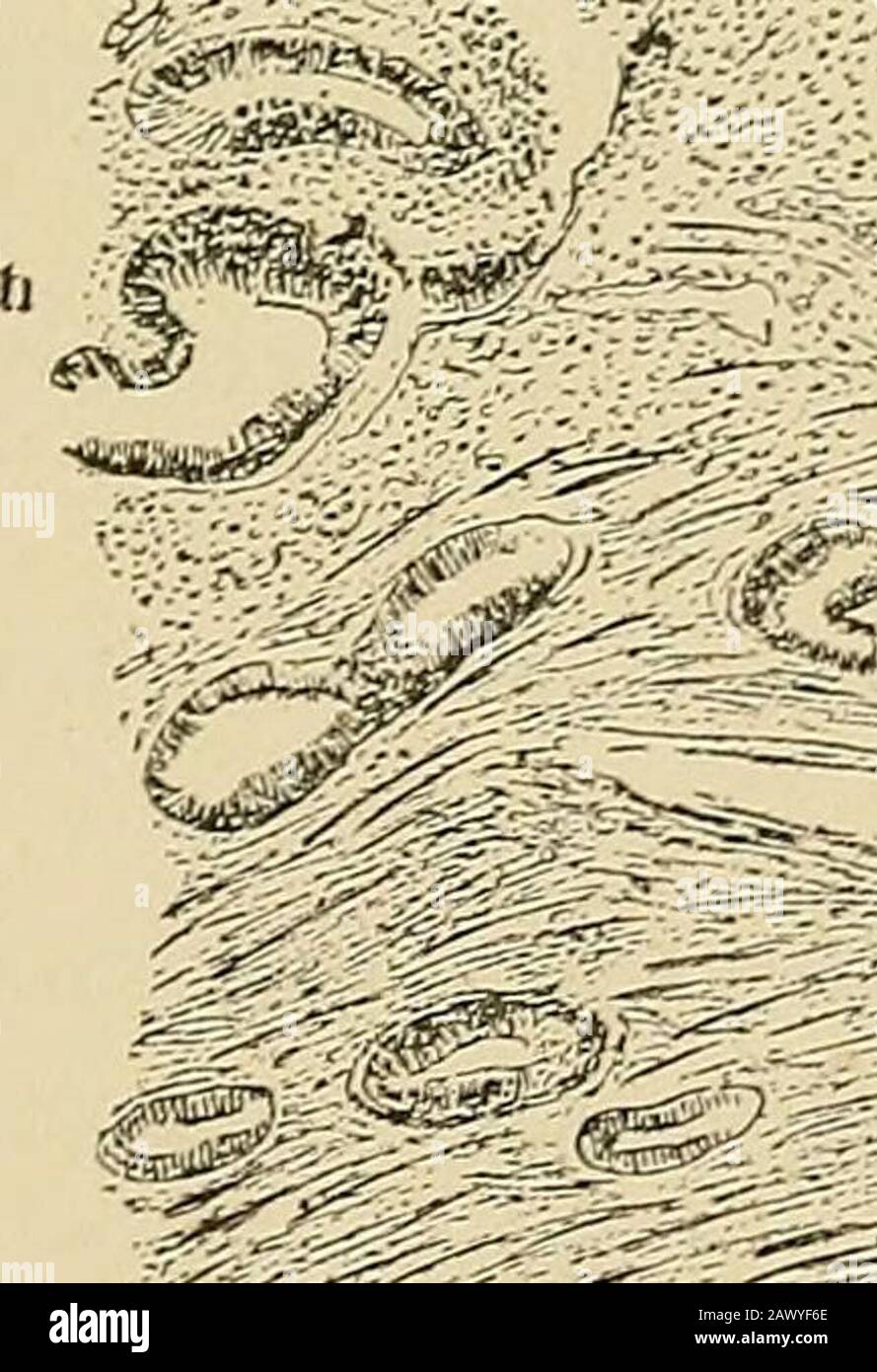 Trattato su gynæcology : medico e chirurgico . superare il loro limite abituale di profondità della mucosa e affondare tra il £ sottostante .-t NO ) *TL- Fig. Investimento Epiteliale op a Gland from the Body op the Utero (Cornil). X 350.Reichert apochromat. Con 00,4. I, Nucleo con granuli ingranditi e filamenti di nucleina; k, nucleusante la cariokinesi iniziale, con disposizione star11 di nucleina; m, piccola, rotondeggiante cellula tra le cellule cilindriche; fibre muscolari secondo Cornil (Fig. 103). Si tratta di un'istanza notevolmente simile a quella chiamata dai anatomisti più anziani Foto Stock