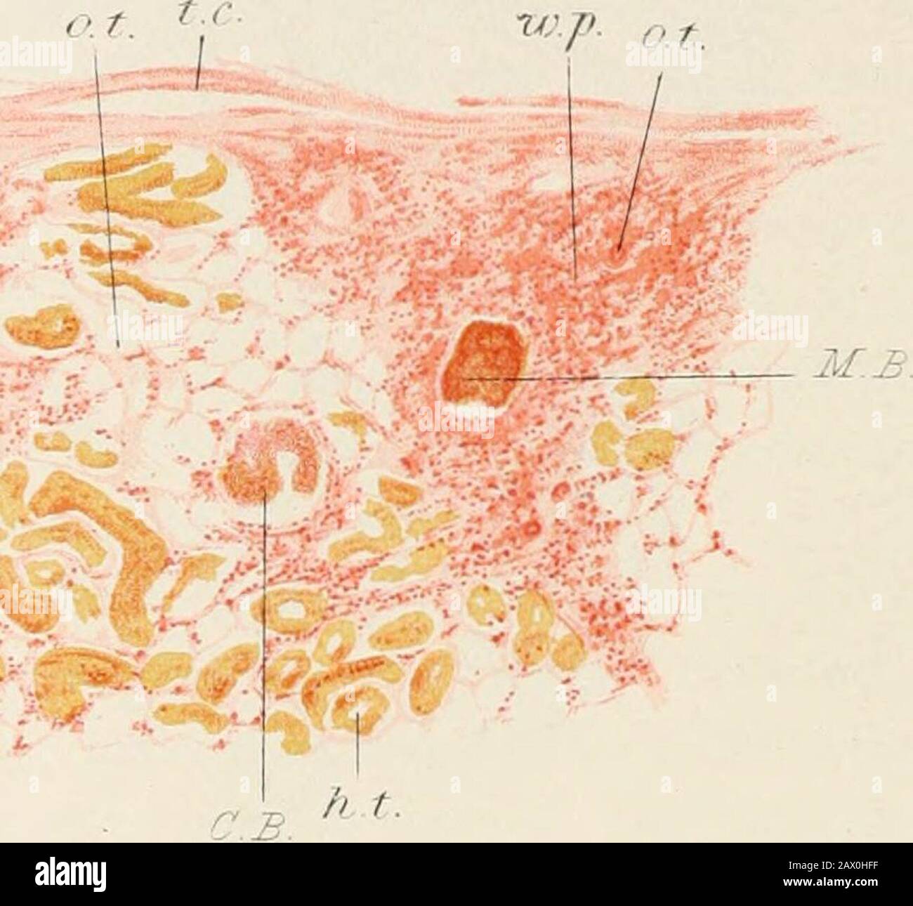 Patologia pratica; manuale per studenti e professionisti . //.£. Spazio cistico intorno al corpo malpigro atrofizzato a margine di area cuneiforme.c.t. Aprire o anche dilatato convoluted e raccogliere tubuli, alcuni contenenti casts.o.a. Sezione di arteria murata spessa, con endurterilis obliterans e ispessimento dell'adentiglia. Pelvi è frecjuently più grasso che è di solito presente intorno thecalyces. Indurire (j^ 62 o 63), macchiare (^^ 103 e 106), chiare (>5 193), emontare (§ 199). 412 IL RENE ( X 20). La superficie corticale libera è molto irregolare, con elevazionie depressioni correspo Foto Stock
