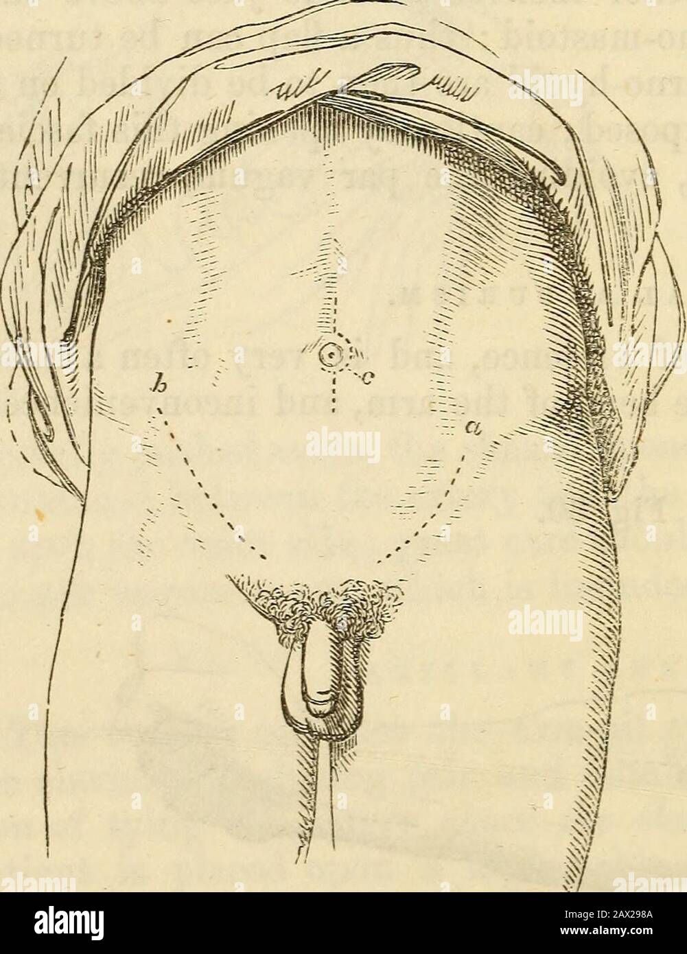 Un manuale di chirurgia: Con cinquanta illustrazioni . o muscolo di carpi ulnaris. ANEURISMA INGUINALE. Questo è un tumore pulsante nel groin, da non confondere con un bubo, ernia, &c. L'ex Fig. 31. L'iliaco esterno è legato mediante incisione makingan (a, Fig. 31),circa 3 J pollici di lunghezza, iniziando su un livello con il processo spinousprocess anteriore superiore, e circa un inchdistante da esso; e con-tinued quasi parallelo con legamento di Pouparts, ad un pollice point1 sopra, e IJ inchesto l'esterno del pubes.Hclosing Attentamente la pelle, fascia superficiale, tendine del ob-lique esterno, oblique interno, a Foto Stock