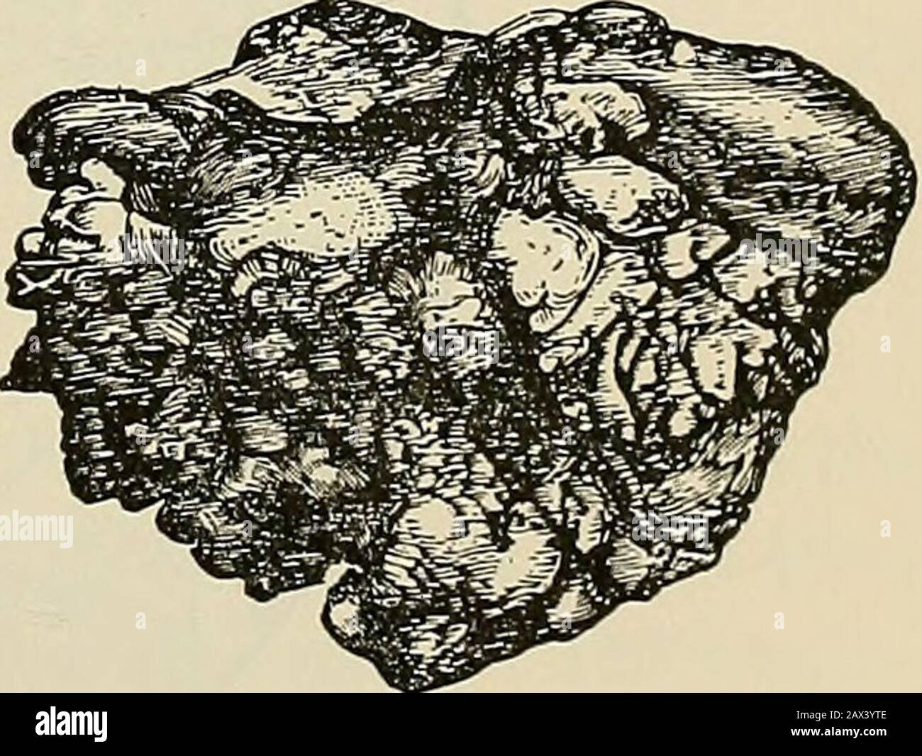 La patologia e il trattamento chirurgico dei tumori rappresenta la dimensione naturale degli elementi di un germe dentale (Fig. 315). Nella maggior parte dei casi i thetumors sono composti da due o più tooth-germs indiscriminatelyfused (Sutton). Si suppone che odon-tomes siano più frequenti nel lower thanin la mascella superiore, ma vi è buona base per la convinzione che molti di questi tumori sono stati descritti come exostosi dell'antrum. La diagnosi di tumori dentali è veryoboscure, e in conseguenza di una diagnosi di faultydiagnosi inutilmente gravi operazioni sono state spesso eseguite per la rimozione di tumori di questo tipo. Foto Stock