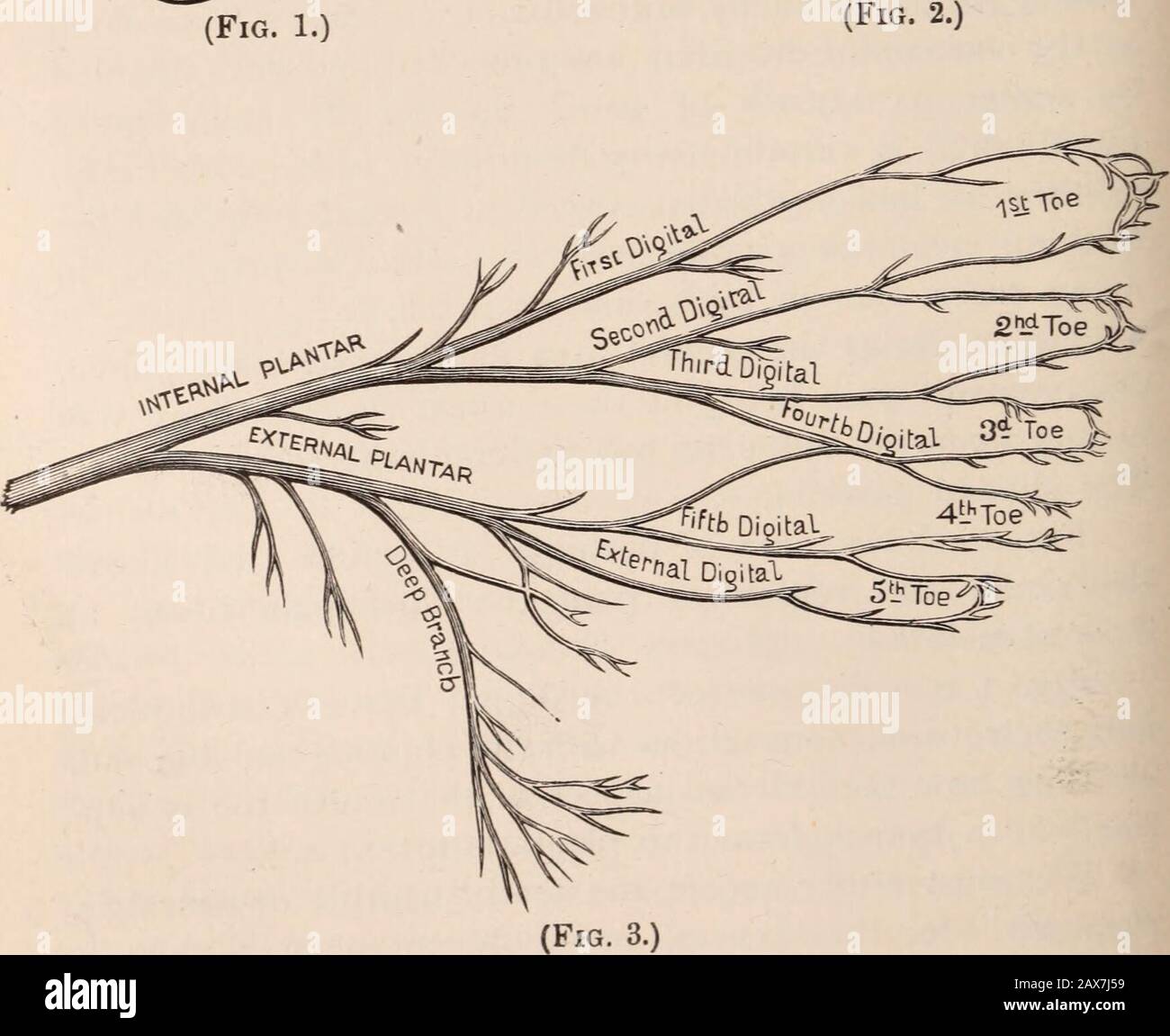 Alieno e neurologo. . – molti casi caratteristici, anche se in nessun modo in tutti. Fig. 1 mostra la zona dolorosa nel primo caso sopra,il dolore più intentoso essendo ai punti più scuri. In questo caso non si è verificato eritema, ma pallore del piede e delle dita dei piedi. Le parti ombreggiate nella Fig. 2 mostra l'area di vampate nel secondo caso sopra descritto, e la regione di dolore, il dolore principale essendo punti più scuri. Fig. 3 è un diagramma della distribuzione del nervo digitale i loro collegamenti del tronco con gli plantari e oltre, mostrando come l'aspetto interno del quarto dito è sup-plied da un ramo dagli impianti i Foto Stock