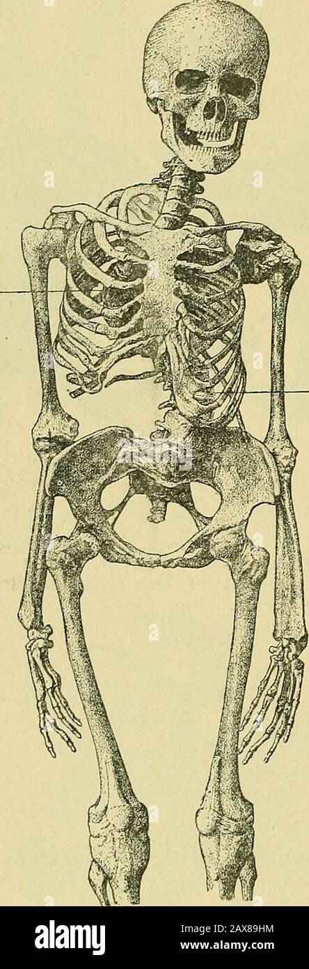 La pratica dell'ostetricia, concepita per l'uso di studenti e professionisti della medicina . Fig. 876. - diagramma Dell'Ingresso pelvico di Fig. 875. 648 MANODOPERA PATOLOGICA. Comprende una combinazione delle malformazioni di cifosi e scoliosi. Esso isan obliquamente contrasse il bacino di minor grado, essendo principalmente deformato nei diametri riscattati. Frequenza ed eziologia: L'eziologia è naturalmente thatdelle due tipologie che fanno questa combinazione. Caratteristiche cliniche: L'esempio più comune di questo tipo è la cifoscoliosi lombo-dorsale. La deformità tekifotica è primaria nel tempo di punta, e, comb Foto Stock