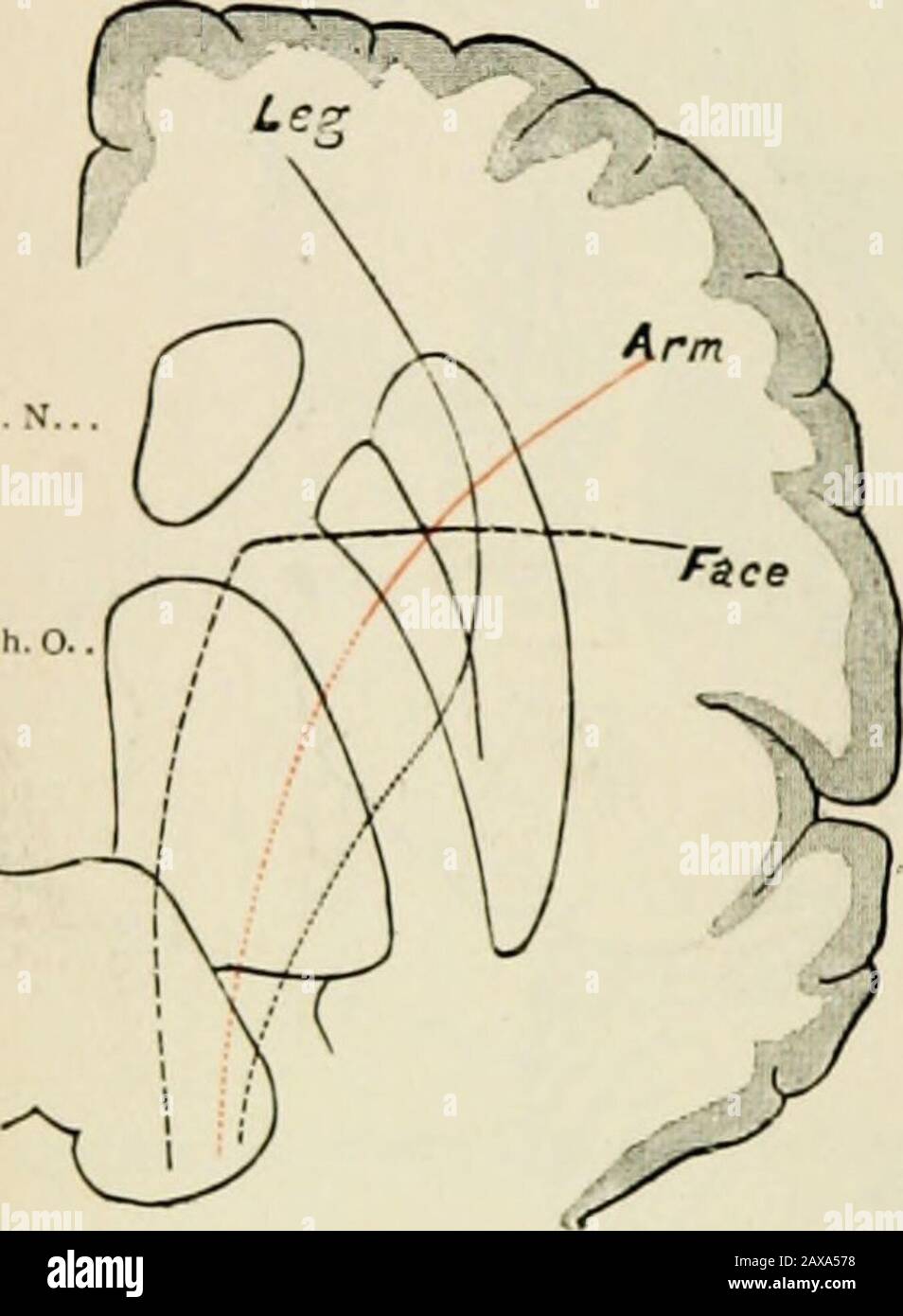 Un trattato sulle malattie nervose dei bambini, per i medici e gli studenti . nd il nucleo lenticolare. Questo tratto di fibre bianche, delimitato dal grigio gan-glia, è chiamato internalcapsulare, in connostinctionto alla capsula esterna, sedicata dagli scrittori più anziani una banda di fiberslying bianco sul lato esterno del nucleo lenticolare, buthaving interesse clinicalmolto piccolo. Nel capsuleo interno le fibre provenienti da theleg, ARM, e sono rivolte al centrosinterlace in modo tale (Fig. 125), che le fibre di sfaccettatura si trovano più interne, le fibre di armatura occupano una posizione mediana di po, e le fibre di gamba lieesterall Foto Stock