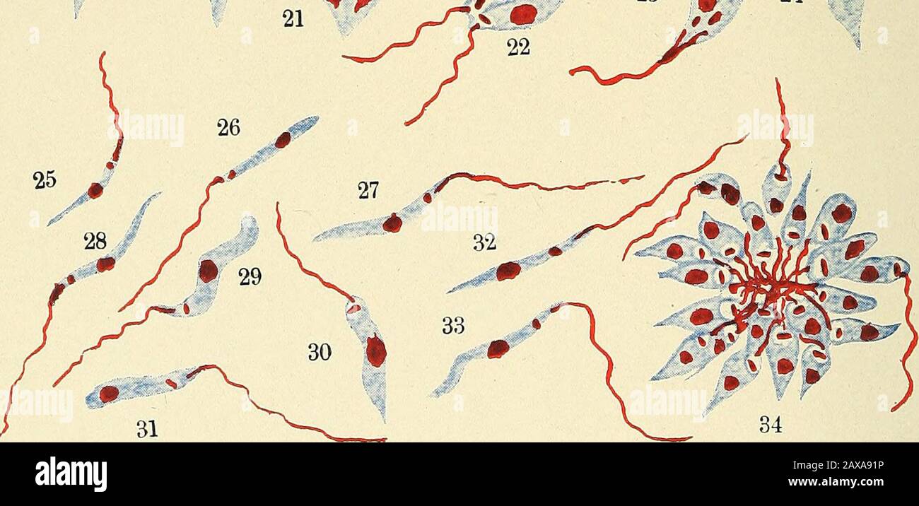 I febbri malarii, la febbre emoglobinurica e i protozoi sanguigni dell'uomo . W^ 20 .^ m ^0 • ^S 18. Foto Stock