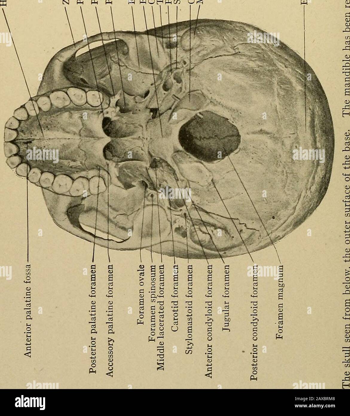 Anatomia applicata e chirurgia orale per gli studenti dentali . processo rygoid della sphenoide, le narici posteriori, la fossa pterigoide, l'eminentia articularis, la glenoidfossa, la piastra timpanica, il processo stiloide, il processo emastoide, la porzione petroica del temporalbone, il basilar e i processi condyloidi dell'occitalbone, l'osso, l'osso e la protuberanza occipitale esterna. Sono visibili importanti foramina: La foramina anteriore, posteriore e accessoria, la foramina palatina, il forame ovale, il forame spinosum, carotide, lacerato medio, stilo-mastoide, lacerato posteriore o giugulare, anteriore e posteriore c Foto Stock