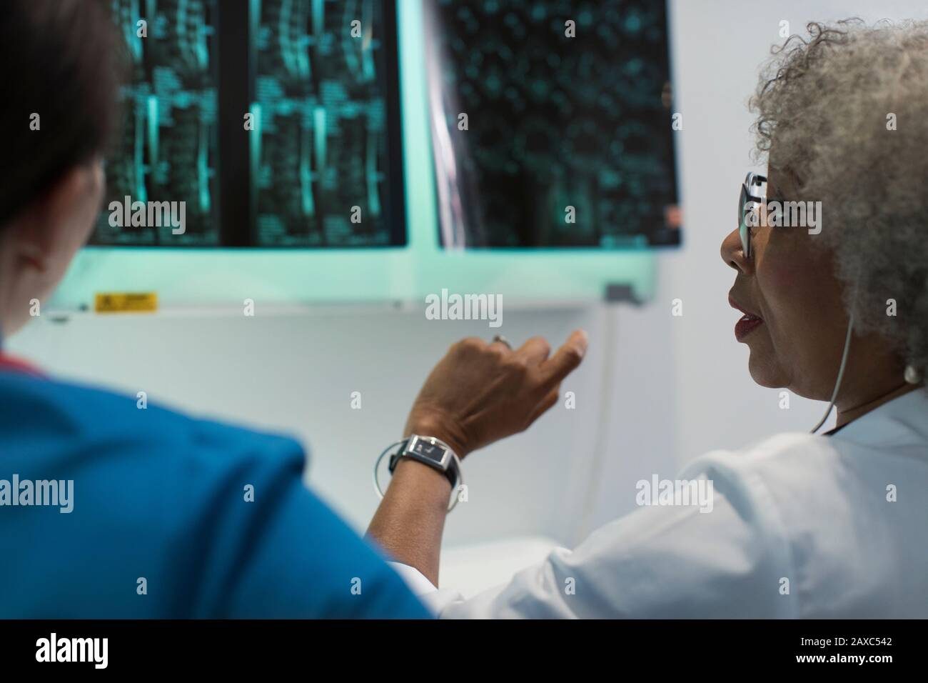 Medici femminili che discutono raggi X in ospedale Foto Stock