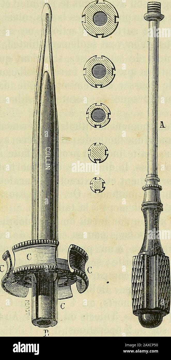 Manuel de médecine opératoire . Dilatateur de Demarquay.D, fermé. E, ouvert. Principe des dilatateurs usités pour la volsion des rétrécisse-ments de lurèthre. Il se compose de quatre valves dont lécarte-ment varie avec le diamètre de la tige centrale. Lorsque les valves fJTiiOTRITIE PÉPaNËÂLE ou TAILLE LITHOTRITIQUE. 049 ont été engagées dans le col de la vessie, on obtient la dilata-tion progressive en introduisant successivement des tiges dunvolume cornetto. Appréciation, à si je me ne sono a carico dabord lexamen desstruments, je dirai que le dilatateur de Guyon, employé égale-. Fig. 7ÎU Foto Stock