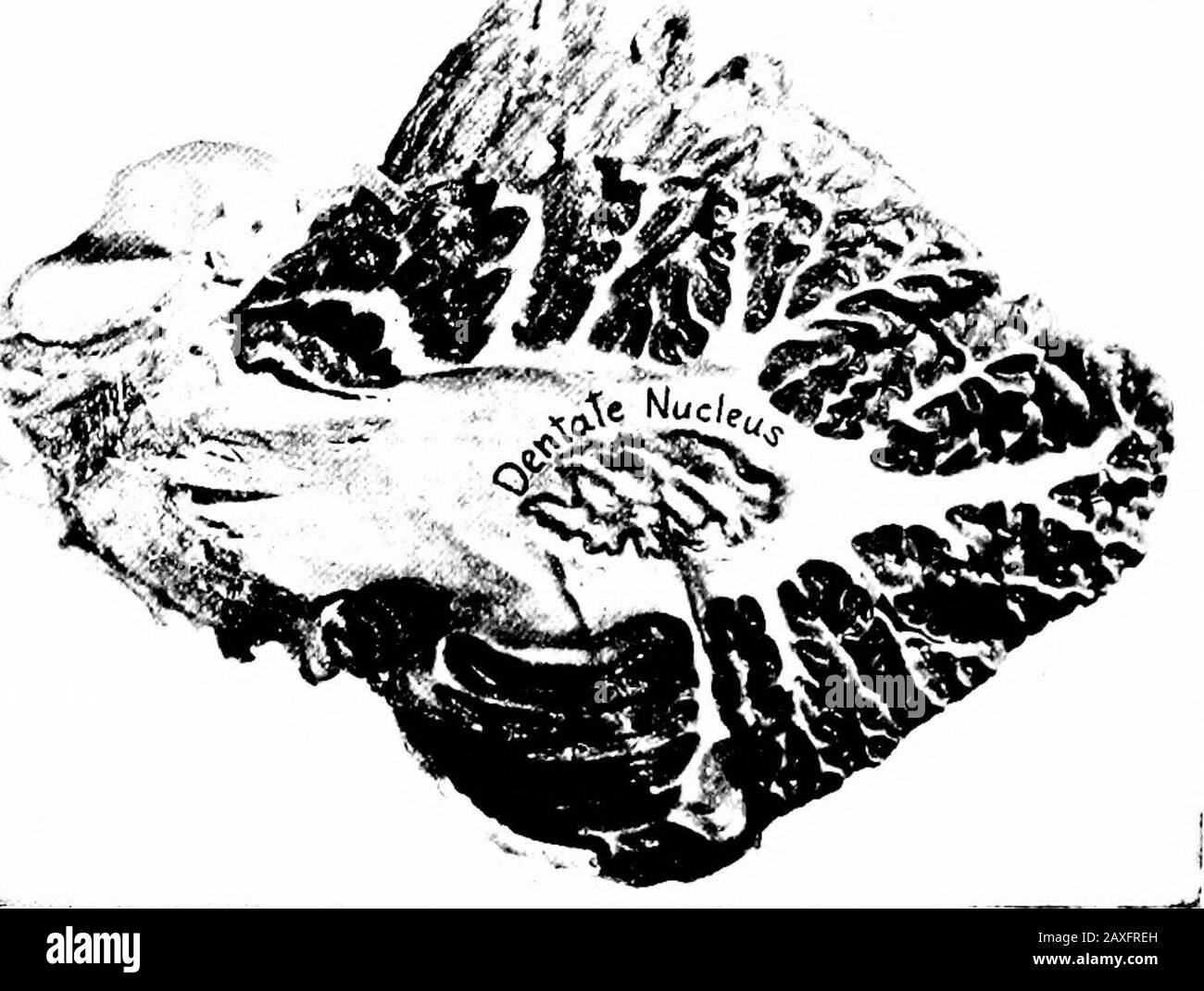 Un manuale di anatomia . superiore. I peduncoli inferiori, o corpi di restionn, entrano nel terebellum sotto gli altri due. Ciascuna è costituita da fibre afferenti andefferenti; le fibre afferenti comprendono: (I) il tratto spinocerebellare dorsolateralsuperficiale (cerebellare diretta) derivato dalla colonna di Clark (nucleo toracico) del midollo spinale e terminante L'ANATOMIA INTERNA DEL CERVELLETTO 409 nel grigio del verma di entrambi i lati (ma in modo chieily opposti); (2)le fibre oligomerebellari (arcuate interne di oblunga) che ariseo nel nucleo olivare e terminano nella corteccia del verma e dell'emi- Foto Stock