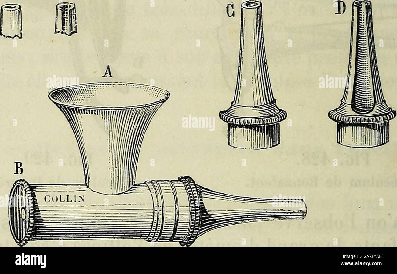 ique de haut en bas, et darrière en avant ; chez ladulte ilse riapproche de la perpendicolaire, quil atteint presque complè-tement chez le vieillard (Lenoir). Pour sassurer de la présence, du volume, de la nature du corpsétranger, il faut pouvoir explorer dans toute son étendue le con-duit auditif. Su ciambella, pour cette Exploration, duspéculum, soit celui de Bonnafont ou de Desarènes (fig. 428, 429), celui-MALGAIGNE. MÉD. OPÉR,, 8* édit. 8 m OPÉRATIONS SPÉCIALES. De Toynbee (fig. 430), dont la dimensione doit être proporzionnée à lalargeur du conduit. Foto Stock