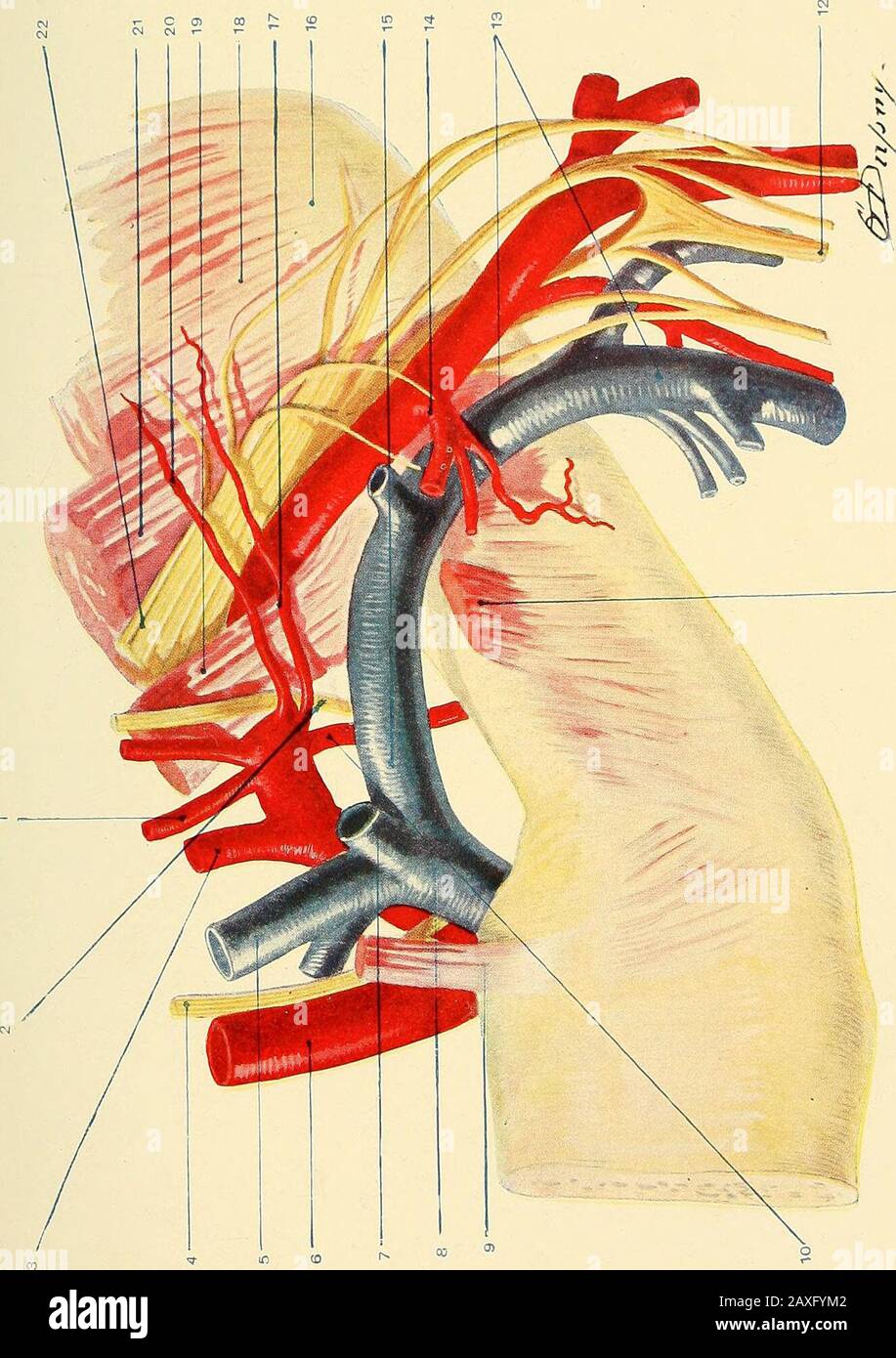 Un manuale di chirurgia operativa . muscoli roid, e fascia del thecervical. È vicino alla trachea, è in contatto con la tepleura sotto e dietro, ed è in stretta relazione con i nervi innomination^interno giugulare, e le vene vertebrali, il vagus, laringeo ricorrente, cardiaco e simpatico. La succlavia sinistra è anche in relazione con il dotto toracico e il nervo frenico. Da questa parte dell'arteria sorgono la vertebrale, la mammella interna, e la tiroidaxis. La seconda parte dell'arteria raggiunge il livello più alto nel collo, e la liestra i muscoli scalenici anteriore e centrale. È ancora dentro Foto Stock
