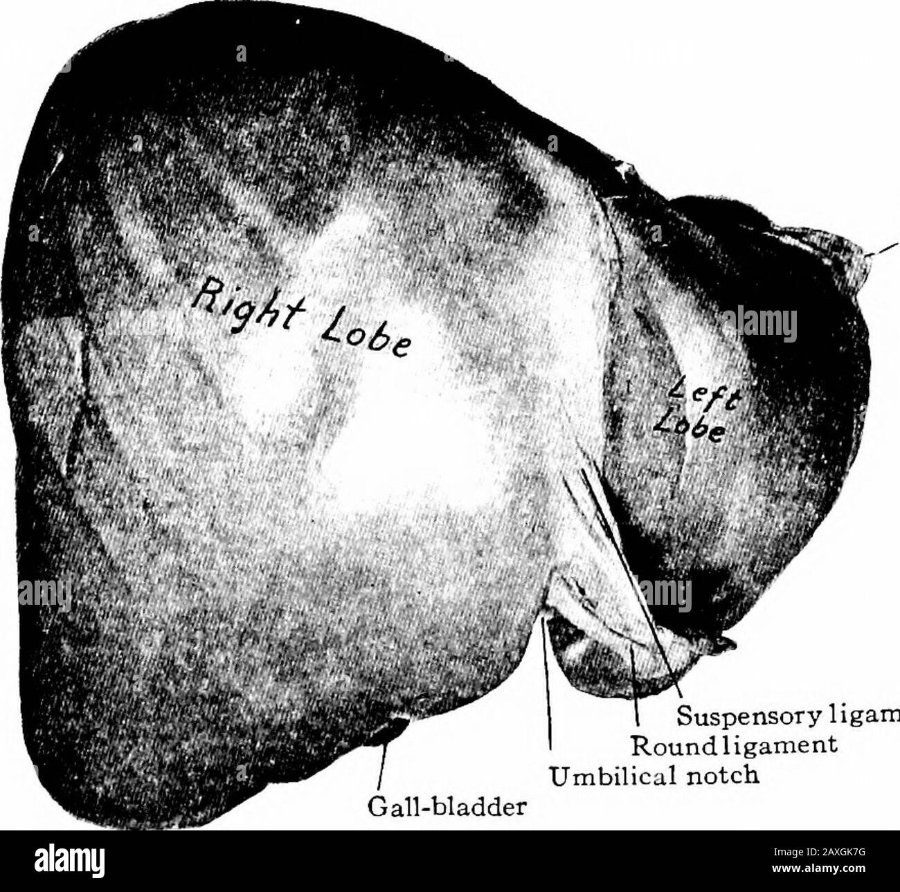 Un manuale di anatomia di forma triangolare e appoggia contro il diaframma. La superficie dorsale [si sbiadisce posteriormente) è convessa, la porzione più grande a destra essendo larga mentre la porzione minore a sinistra è stretta e viene 3IO IL TRATTO ALIMENTARE ad un punto. A sinistra dell'unità centrale Dell'Uver è la vertebralgrove profonda in cui L'Uver è stampato intorno alla vertebra sporgente. La maggior parte di questa superficie è ininvestita con il peritoneo ed è chiamata area scoperta. Questa area è da 2 a 3inches (da 5 a 7,5 cm.) dall'alto verso il basso a 4 a 5 pollici (da 10 a 12,5 cm.) da lato a lato. Thi Foto Stock