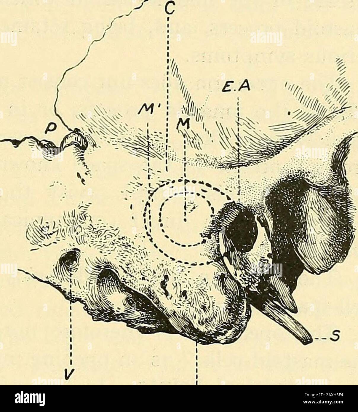 Un manuale di chirurgia operativa . tal, oc-cipital, e ossa temporali. Questa cresta o sopramastoidcrest (vedere c, Fig. 216) essere sempre avvertiti, come anche la depressione leggera all'estremità di itshinder in cui l'osso parie-tal si inserisce. 2. La sinusoide laterale rigata la pro-cess mastoide per un terzo a metà della sua larghezza, Moredehondy ed estesamente regola di asa sul lato destro del corpo che il left.Running giù obliquyfrom la depressione uomini-ha posto sopra al bordo anteriore del mastoidprocess è un fortemente-markedridge prodotto dall'inser-tion del muscolo sterno-mastoide. Questa cresta corrisponde, come r Foto Stock