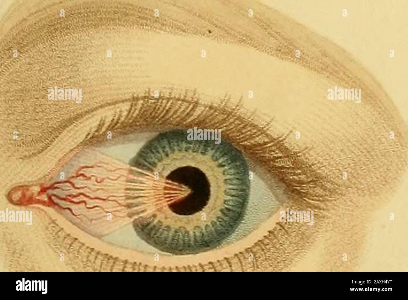 Conferenze sulla chirurgia operativa dell'occhio, o, un'indagine storica e  critica sui metodi raccomandati per la cura della cataratta per la  formazione di una pupilla artificiale, &c&c&c: contenente un nuovo metodo  di funzionamento