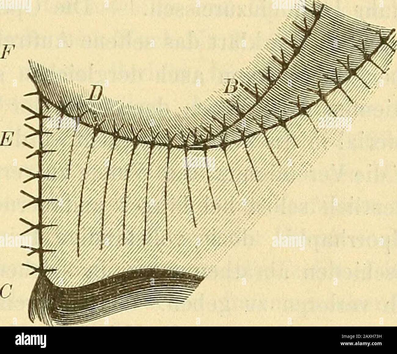 für Ärzte (vorträgen P g^/o) oder Sublimatlösuug(1: 10000) ausgeführt. Carbollösung Nachtheile habe ich davon noch nicht gesehen,ja ich finde, dass es sich unter dieser ununterbranchenen Abspülung desWundfeldes ganz besonders angenehm arbeiten lässt. Die Nachbehandlung ist eine möglichst exspecitative. DiePatienten müssen 3 Wochen streng auf dem Rücken liegen mit festzusammengebundenen Beinen. Zur Verrichtung ihrer Bedürfnisse werdenniedrige Bettschüsseln untergeschoben, und wenn die U Foto Stock