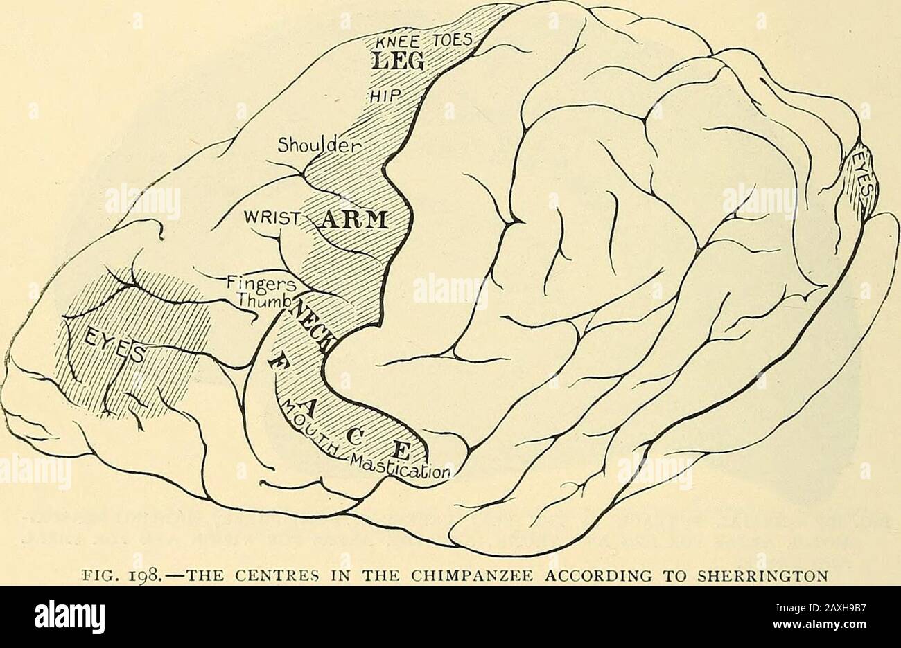 Un manuale di chirurgia operativa . che cendo convoluzione frontale. In molti casi possono essere interessate zone più ampie, in modo che il foro della filina debba essere allargato; ma l'apertura primaria deve essere fatta sull'area corticale corrispondente o alla parte più colpita o prima colpita se paralizzata, o alla parte in cui gli spasmi iniziano, se vi è Jacksonianepilessia. 8 OPERAZIONI SU TESTA E COLLO [parte hi 2. Centri di parola. - Le aree corticali interessate in speechare situato sul lato sinistro del cervello, e sono quattro in numero - vale a dire il discorso uditivo, il discorso visivo, il discorso motorio, e il mot Foto Stock