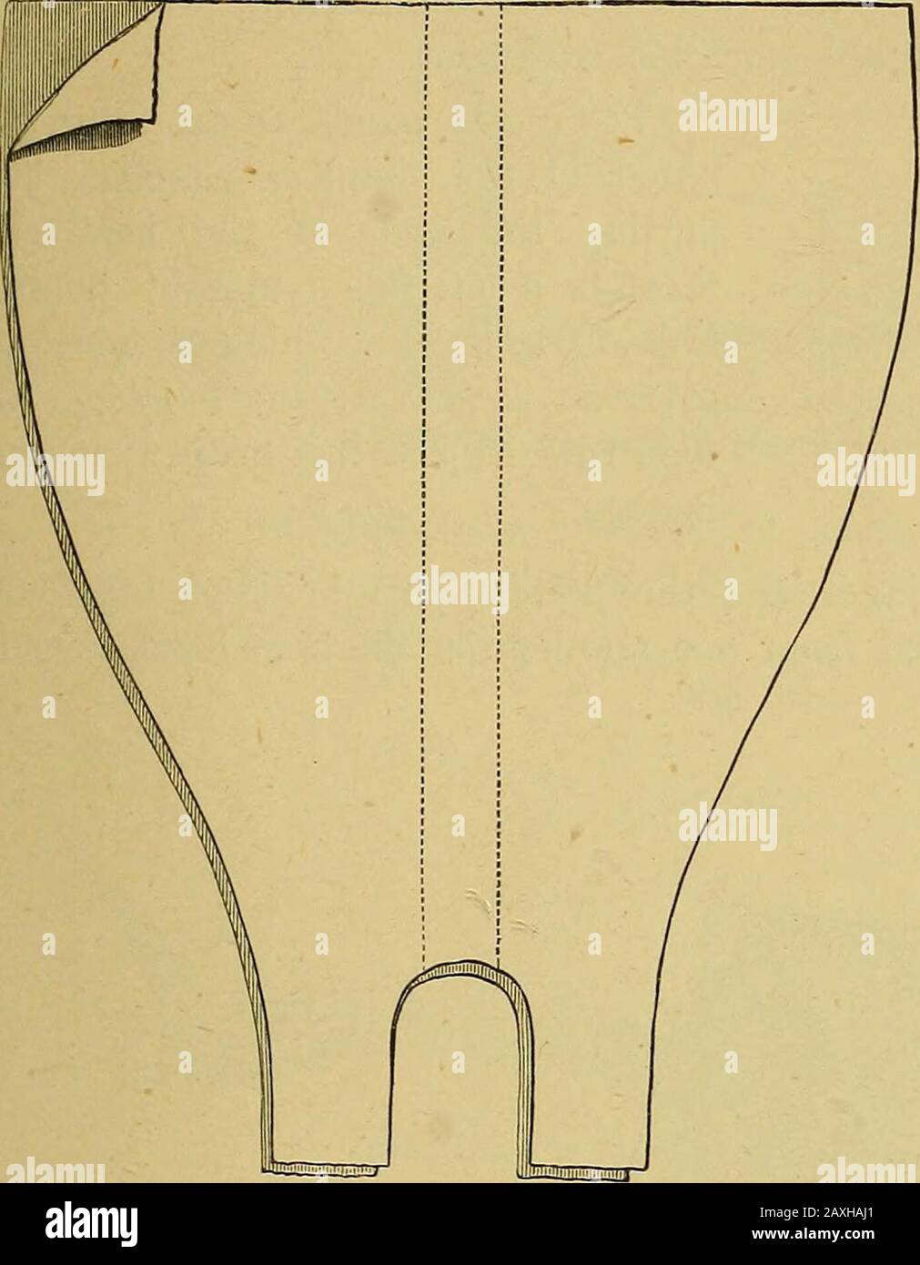 Il manuale del chirurgo sul trattamento dei feriti in guerra : un saggio premio . Intonaco di Paris bendaggio in molte code. Bendaggio intonaco o Parigi di sacco grosso. 8. La stecca bavarese (fig. 74 e 75). Intonaco - crema è pouredbetween due pezzi di lino o calico, che è cucita insieme pagliaccio emiddle, e l'arto avvolto in esso. Non appena l'intonaco si è posato, le due metà, che sono collegate tra loro mediante cucitura, possono aprirsi, e le parti ferite esposte (amovo-inamovibel). 9. Di mazzi di canapa, lino o iuta, che sono immersi in cartongesso di Parigi e bendati alla lim Foto Stock