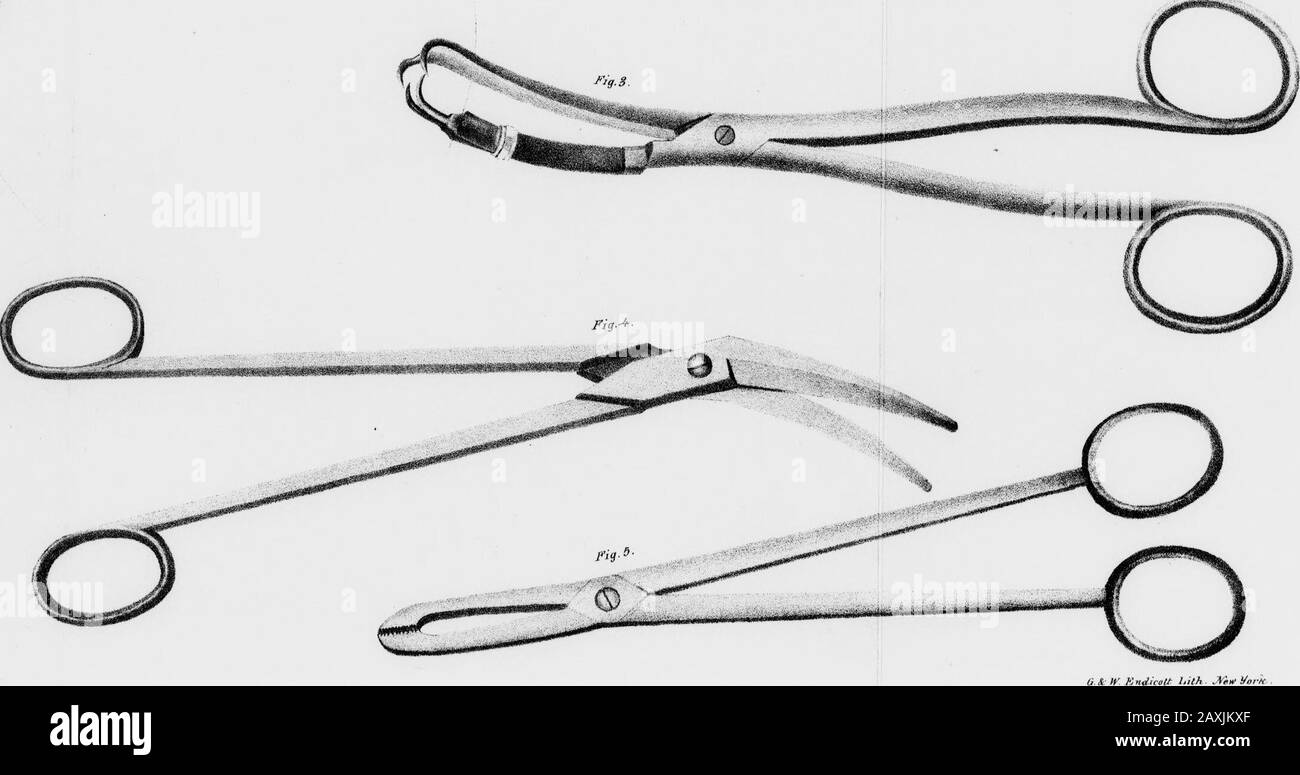 Un trattato sulle malattie dei passaggi dell'aria : comprendente un'indagine sulla storia, la patologia, le cause e il trattamento, di quelle affezioni della gola chiamate bronchite, laringite cronica, mal di gola del clergyman, ecc... »8^teW3WWW»SJSi^**f-- - v:.!3;f»?«>(*|^. (I& W Kndieott hith MwVtrH. INDICE. Età, causa della malattia Aphonia ......Anatomia Della Trachea Bronchi Larynx . Artioide CartilagesAmmonia Muriateappendiaappendia....Bronchi, Lesioni Di Membrana Bronchiale, ispessimento di Bronchitis complicato .Broussais, sistema fisiologico di Brunner, ghiandole di Boudin M. lavoro di Cause di Follicula Foto Stock