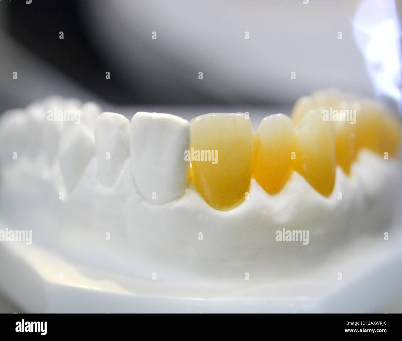 modello di denti umani con denti artificiali in primo piano Foto Stock