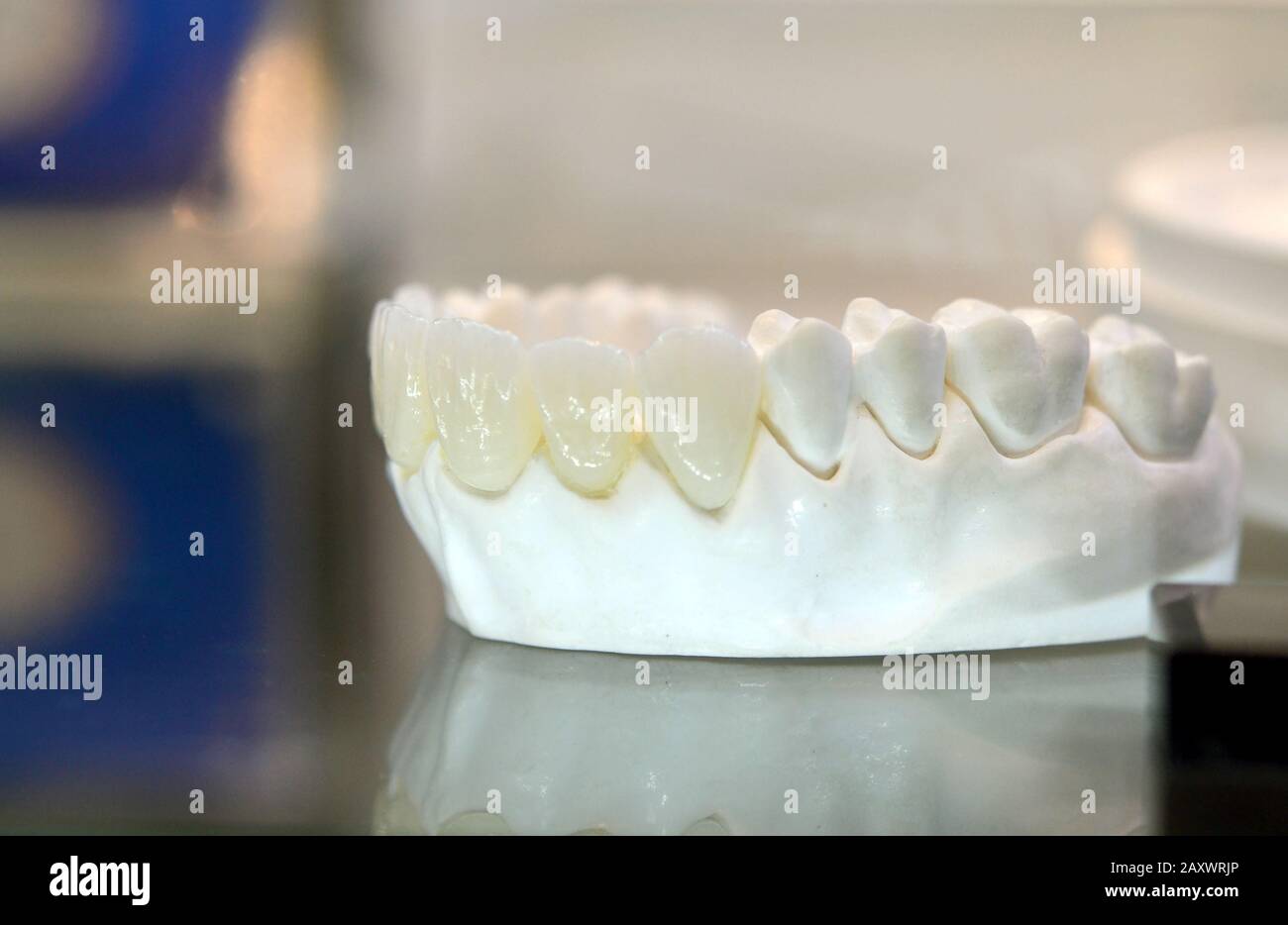modello di denti umani con denti artificiali in primo piano Foto Stock
