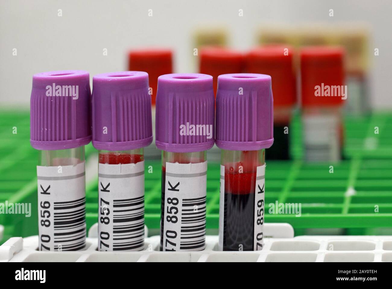 donazione di sangue Foto Stock