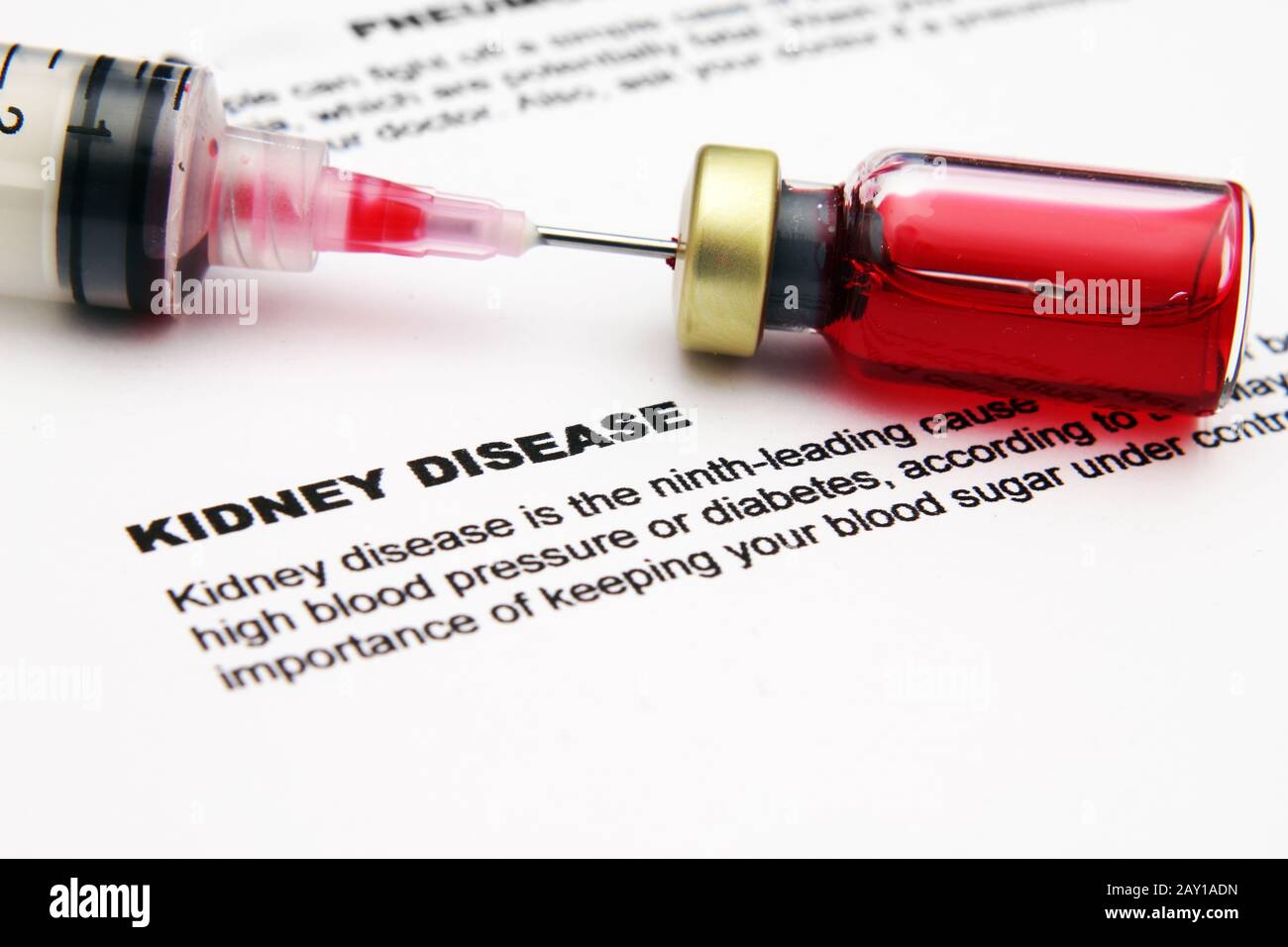 Malattia renale Foto Stock