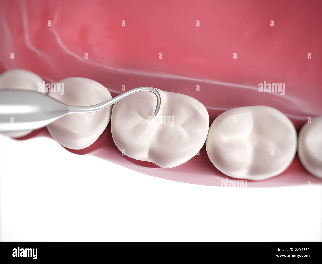 3d reso illustrazione di una pulizia dei denti Foto Stock